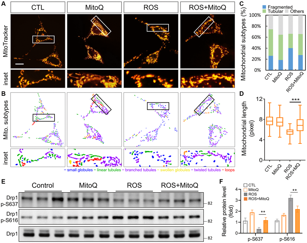 Effects of MitoQ on imbalances in mitochondrial dynamics in ROS-exposed granulosa cells. (A) Mitochondrial network was stained with MitoTracker Green and analyzed using a fluorescence microscopy with image acquisition. (B) The images below were divided into six major categories based on the morphology of the mitochondria. (C) Three main mitochondrial types were quantified: fragmented, tubular and others. (D) The total length of each mitochondrion was assessed. (E) The levels of mitochondrial fission protein Drp1 were analyzed by immunoblotting. (F) Quantification of Drp1 phosphorylated protein levels. **p ***p 