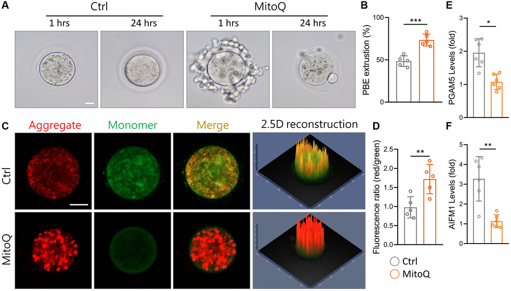 Effect of MitoQ on in vitro maturation of aging mouse oocytes and mitochondrial function. All oocytes were matured in vitro with 10 nM MitoQ for 24 h from 51-week-old B6 mice. (A) Representative images of in vitro maturation of oocytes from aged mice. (B) The quantification of first polar body extrusion from mice oocytes. (C) Mitochondrial membrane potential (Δψm) assessed by JC-1 staining in control and supplemented MitoQ oocytes (red, Δψm high; green, Δψm low). (D) Quantification of the ratio of red to green fluorescence intensity in control and MitoQ-supplemented oocytes. (E, F) The levels of oxeiptotic core genes were determined by qPCR. Scale bar, 25 μm. *p **p ***p 