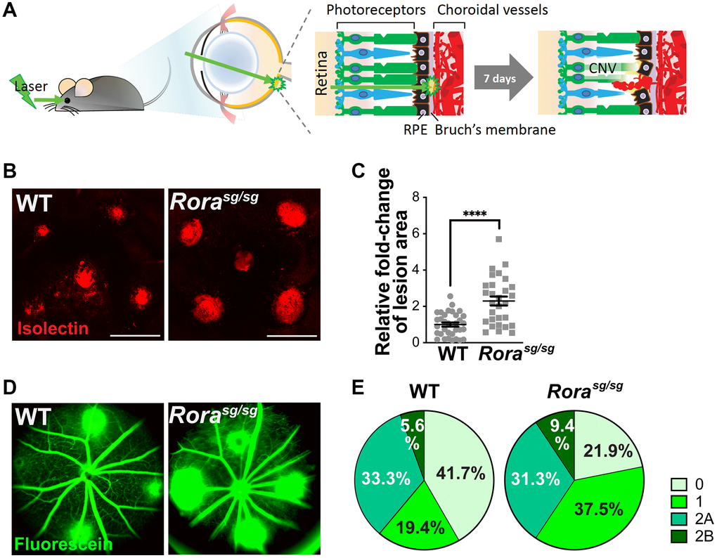 Genetic deficiency of RORα increased lesion size and vascular leakage in a mouse model of laser-induced choroidal neovascularization (CNV). (A) A cartoon illustrating laser-induced CNV model in mice. Young adult mice are exposed to laser, which ruptures Bruch’s membrane and causes CNV. (B) Representative images of choroidal flat mounts with laser-induced CNV from wild type (WT) and RORα-deficient (Rorasg/sg) mice stained with isolectin IB4 (red) showing four lesions, with optic disc in the center. Scale bars, 500 μm. (C) Quantification of the relative fold-change of CNV lesion areas showed that RORα-deficient mice have larger CNV lesion sizes compared to age-matched WT (n = 22–23 eyes/group). Each data point represents averaged lesion size from one eye. Solid horizontal bars indicate means ± SEM; ****P ≤ 0.0001. (D) Representative images of fundus fluorescein angiography (FFA) from WT and Rorasg/sg mice with laser-induced CNV at day 6 after laser photocoagulation. (E) Lesions were graded on an ordinal scale of the fluorescein (D; green) leakage appearance: grade 0 (no leakage); grade 1 (questionable leakage); grade 2A (leaky); grade 2B (pathologically significant leakage). Rorasg/sg mice revealed much fewer grade 0 lesions and more grade 1, 2A and 2B lesions compared to WT mice (n = 10 mice/group).