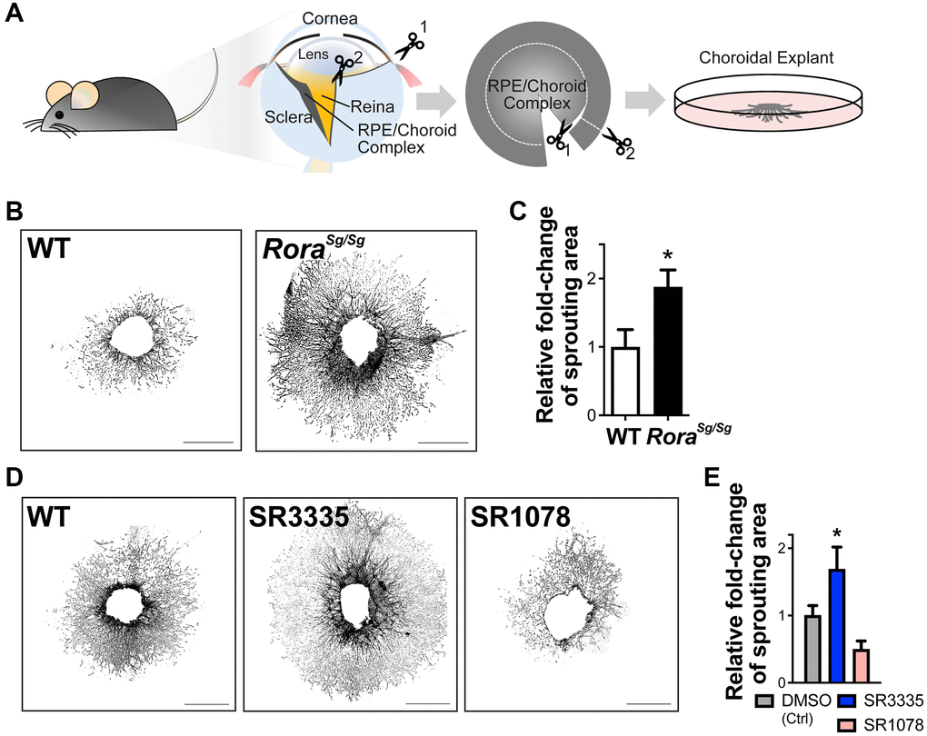 RORα regulates choroidal sprouting ex vivo. (A) A cartoon illustrates the experimental steps of choroidal explant assay by isolation, dissection and culture of choroid fragments. (B) Representative images of choroidal sprouting assays from age-matched WT and Rorasg/sg mice. Scale bars, 1 mm. (C) Quantitative analysis of the choroidal sprouting area from 5 days after explantation showed that Rorasg/sg choroids have significantly increased sprouting ability ex vivo compared to WT. n = 3–5 mice (10–12 explants)/group. (D) Representative images of choroidal explants isolated from C57BL/6J mice and treated with SR3335 (RORα inverse agonist), SR1078 (RORα/γ agonist) or vehicle control DMSO (all at 5 μM). Scale bars, 1 mm. (E) Quantification of the sprouting area indicated that inhibition of RORα with SR3335 significantly increased choroidal sprouting area while SR1078 reduced the choroidal sprouting ability compared to the DMSO (control) treated group. n = 3 mice/group; 10–12 explants per treatment. Data are presented as mean ± SEM. *P ≤ 0.05.