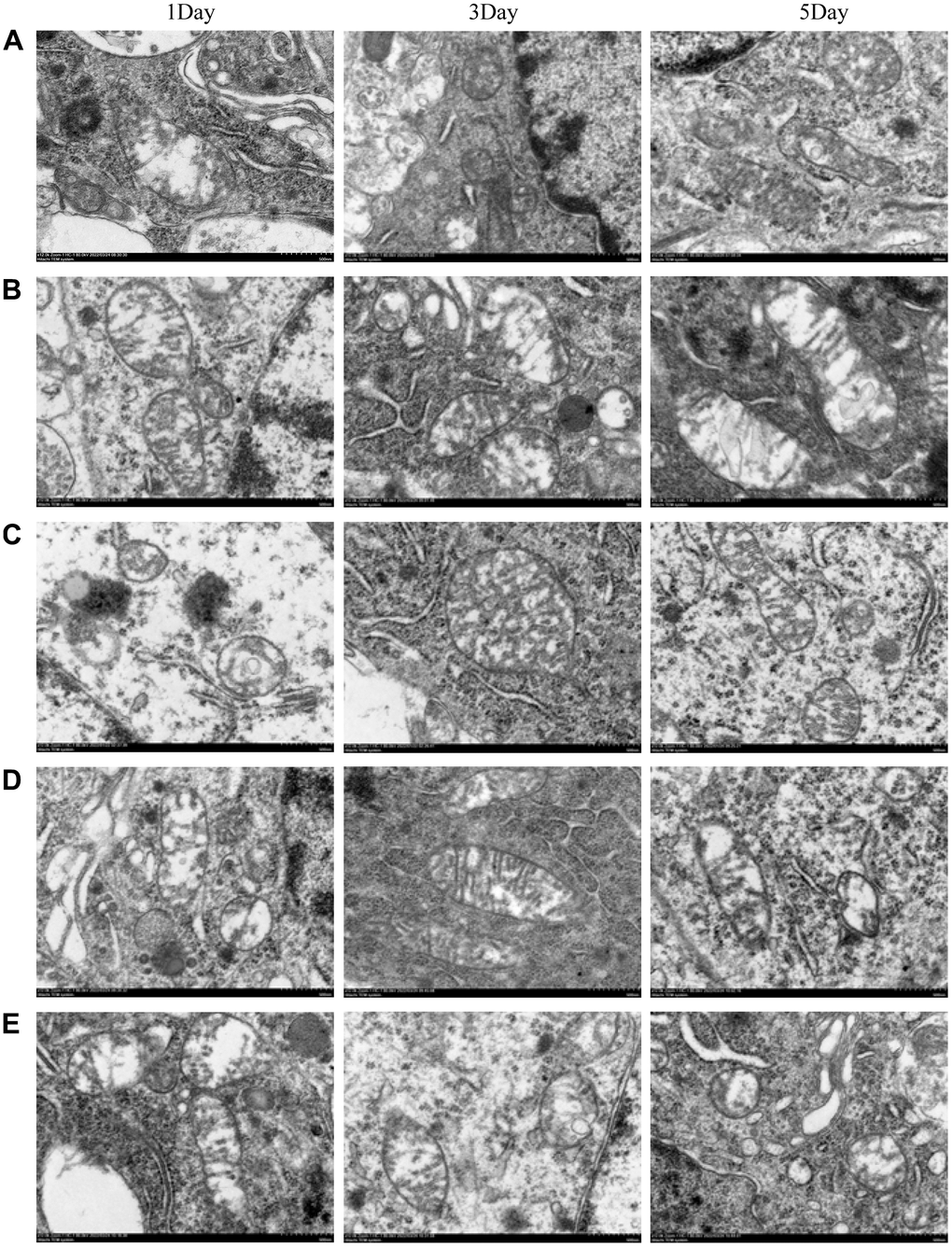 The morphological changes of mitochondria were observed by transmission electron microscopy. (A) blank group, (B) solvent group, (C) NBP group, (D) NBP + agonist group, and (E) NBP + inhibitor group. (Scale bar = 20 μm, magnification = 1200x).