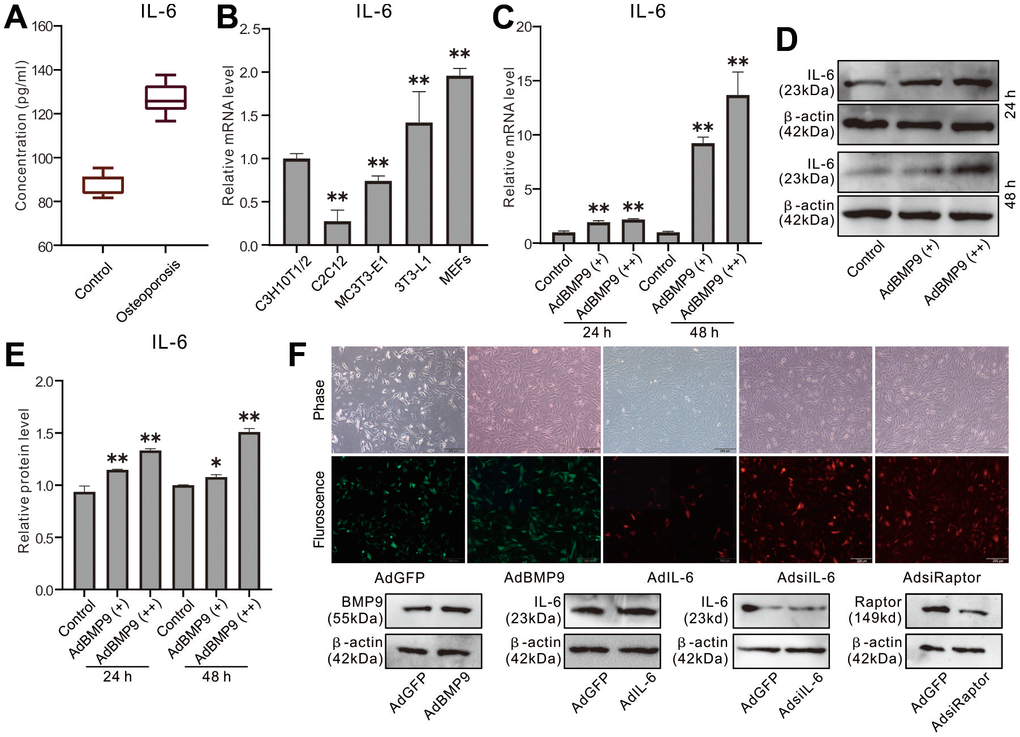 Effect of osteoporosis and BMP9 on IL-6 Expression in MSCs. (A) Rat serum level of IL-6 was measured with ELISA. (B) Endogenous IL-6 mRNA expression was measured with real-time PCR. (C) Effect of BMP9 on IL-6 mRNA expression was measured with real-time PCR. (D) Effect of BMP9 on IL-6 protein level was assayed with western blot. (E) quantification result of western blot assay shows the effect of BMP9 on IL-6 protein level. (F) The effect of recombinant adenoviruses on the target protein level were measured with western blot assay (upper panel show the infection of recombinant adenoviruses in MEFs). (*P **P 