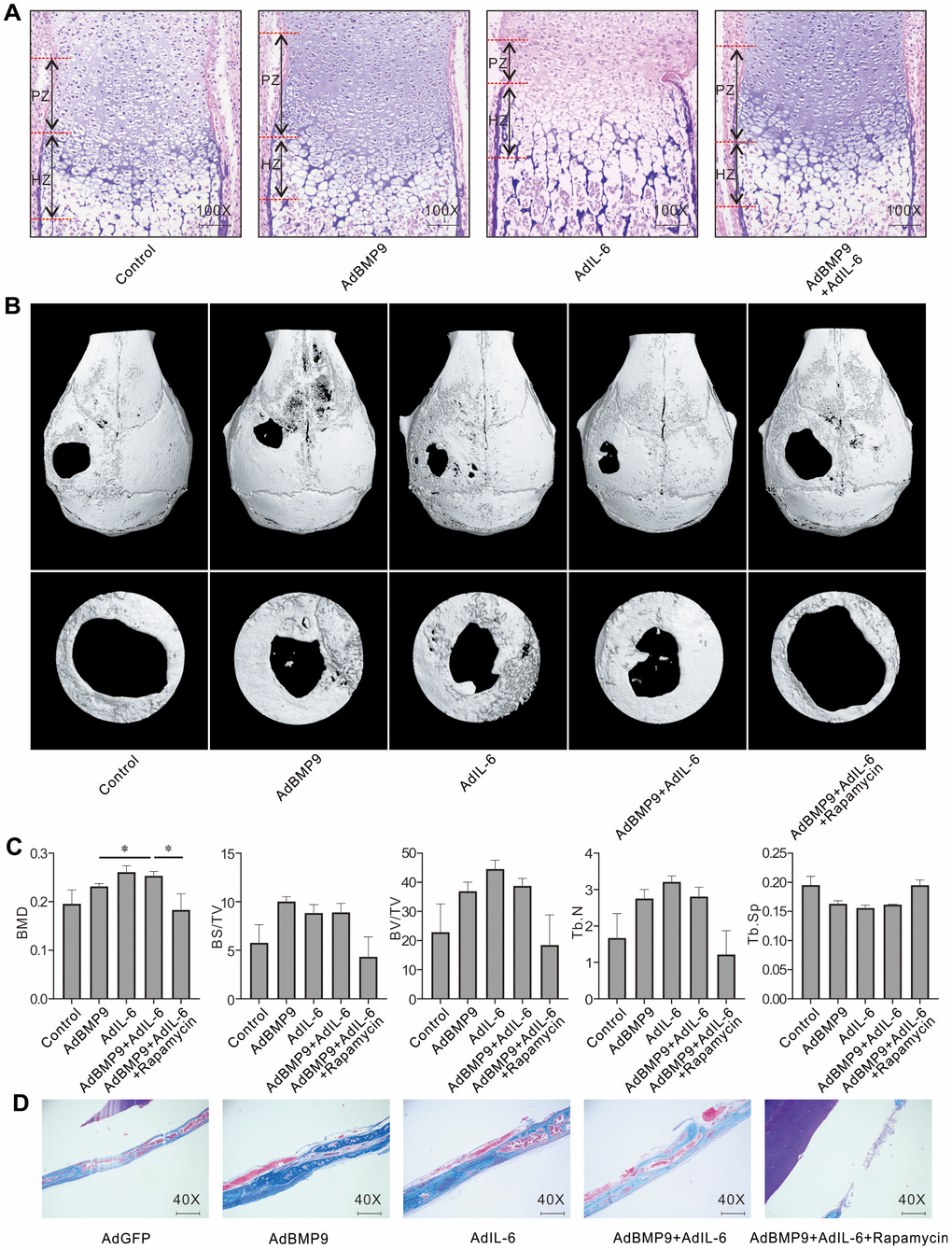 Effect of IL-6 and/or rapamycin on BMP9-induced bone formation and bone defects repair. (A) Effect of BMP9 and/or IL-6 on growth plate was measured using fetal limb culture (PZ: proliferation zone, HZ: hypertrophic zone; Scale bar: 250 μm). mTOR phosphorylation (p-mTOR) was measured using immunofluorescent stain and confocal assay. (B) Effect of BMP9, IL-6, and/or rapamycin on bone defects repair was measured using μ-CT scan. (C) Quantification analysis μ-CT scan shows the effect of BMP9, IL-6, and/or rapamycin on bone defects repair. (D) Effect of BMP9, IL-6, and/or rapamycin on bone defects repair was measured using Masson trichrome stain (Scale bar: 250 μm). (Rapamycin: mTOR inhibitor. BMD: Bone mineral density, BS/TV: Bone surface density, BV/TV: Percent bone volume, Tb.N: Trabecular number, Tb.Sp: Trabecular separation). (*P 