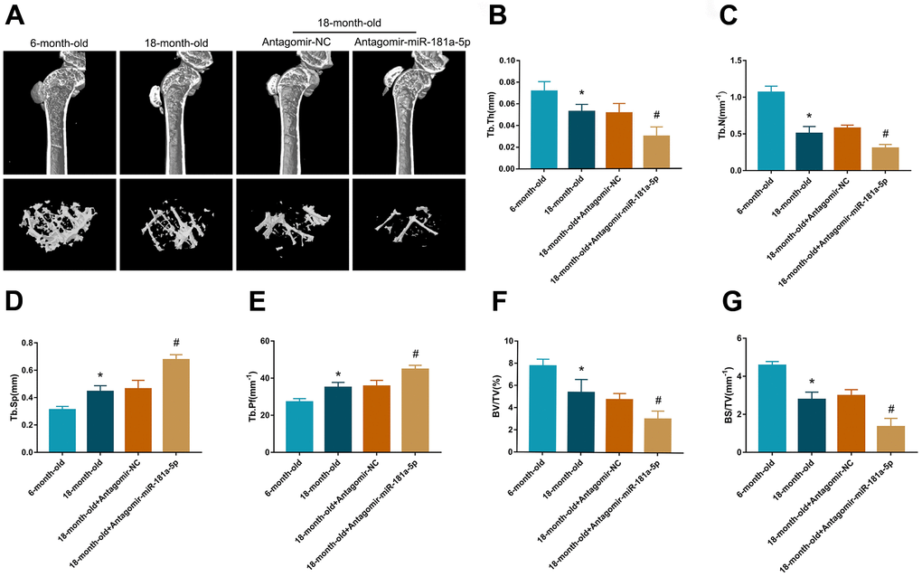 Inhibition of miR-181a-5p aggravated senile osteoporosis in mice. (A) Representative 3D reconstruction images of microarchitecture in the mice tibia. Groups are divided as follows: 6-month-old mice, 18-month-old mice, 18-month-old mice treated with antagomir-negative control (NC) and 18-month-old mice treated with antagomir-miR-181a-5p. (B–G) Micro-CT analysis includes trabecular thickness (Tb.Th), trabecular number (Tb.N), trabecular separation (Tb.Sp), trabecular pattern factor (Tb.Pf), bone volume fraction (BV/TV) and bone surface density (BS/TV). All data represent mean ± s.e.m. (n = 5). *P#P