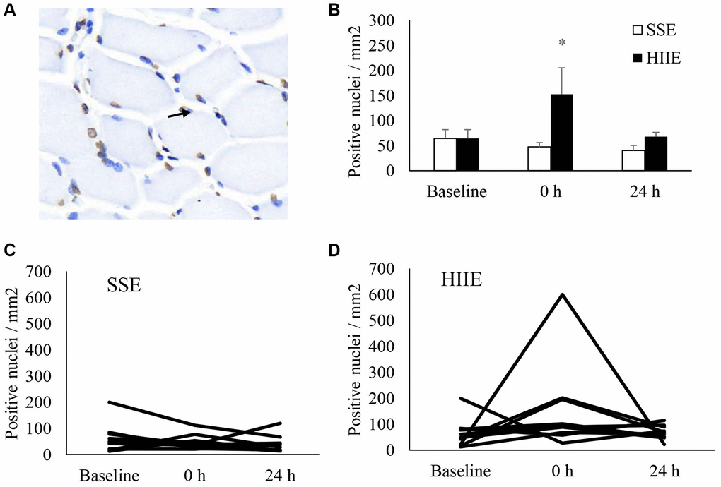 DNA strand break in human skeletal muscle after SSE and HIIE. Approximately one third of nuclei (blue) showed fragmented DNA (brown) at pre-exercise baseline (A). The fragmented DNA elevated by 1.3 folds immediately after HIIE and returned to baseline in 24 h (B). Individual response after SSE (C) and HIIE (D) are shown in the lower panel. *Significance against pre-exercise baseline, p †Significant difference against SSE, p 