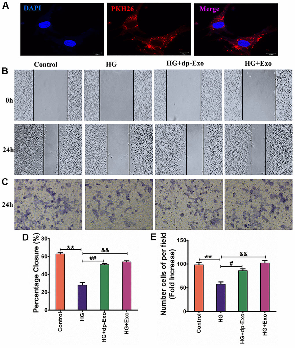 HF-MSC-Exo can be uptaken by HaCaT cells and promote the migration of HG-treated HaCaT cells. (A) HF-MSC-Exo was labeled with PKH26, a lipid membrane-intercalating dye. The labeled exosomes were introduced to the culture medium of HaCaT cells. After 24 hours, HaCaT cells were fixed, counterstained with Hoechst 33342, and analyzed by fluorescent microscopy. The images showed that the labeled HF-MSC-Exo entered into the cytoplasm of HaCaT cells. Scale bar=200 μm. HaCaT cells were treated with HG and subsequently cultured in the presence of HF-MSC-Exo or HF-MSC-dp-Exo for 24 hours. The control cohort was the normal HaCaT cells. (B, C) HaCaT cells skin wound healing and cell migration experiment after treated with different culture medium for 24hours. (D, E) Quantified the proportion of wounded area closure and cell migration rate. (n=3); **P##P&&P