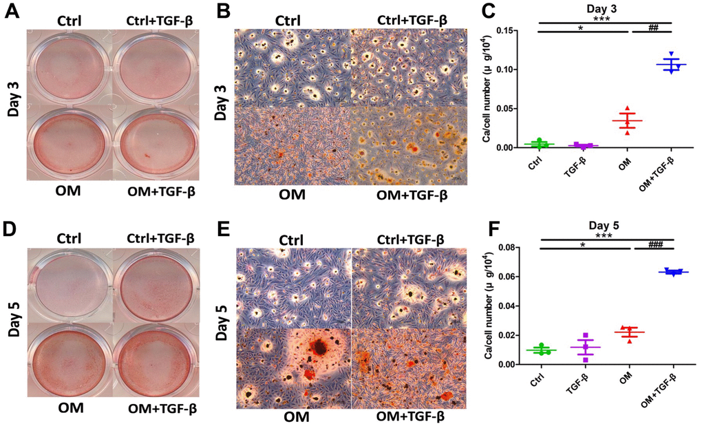 The context-dependent influences of TGF-β1 on VC, based on different test strategies, during the early and mid- term phases of calcification. OM and TGF-β1 synergistically increased calcification upon co-treatment. During early (day 3) calcification, ASMCs exposed to TGF-β1 alone, OM alone, or in combination, were stained using AR, with gross (A) and microscopic (B) images shown. Calcium quantitation results of ASMCs without or with TGF-β1 alone, OM alone, or in combination during early calcification are shown in panel (C). During mid-term (day 5) calcification, ASMCs exposed to the same condition were stained with AR (gross, D; microscopic, E) images shown. Calcium quantitation results during mid-term calcification are shown in panel (F). AR, Alizarin red; ASMC, aortic smooth muscle cell; ctrl, control; OM, osteogenic media; TGF-β1, transforming growth factor-β1; VC, vascular calcification.