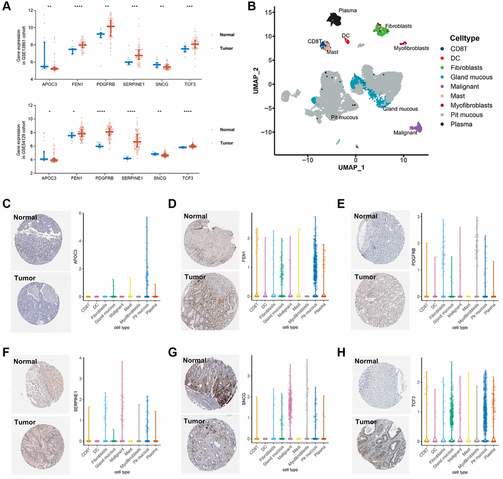 Validation of the key genes expression in GC tissue and single cell localization. (A) Expression of SERPINE1, FEN1, PDGFRB, SNCG, TCF3, and APOC3 between GC tumor and normal tissues in the GSE54129 cohort. (B) Seven cell types identified in the gastric cancer GSE134520 dataset by single cell RNA sequencing (scRNA-seq) profiles and the calculation of uniform manifold approximation and projection (UMAP). (C–H) Immunohistochemistry staining in stomach normal tissues (left, upper) and gastric tumor tissues (left, lower), and scRNA-seq expression levels of APOC3 (C), FEN1 (D), PDGFRB (E), SERPINE1 (F), SNCG (G), and TCF3 (H), respectively.