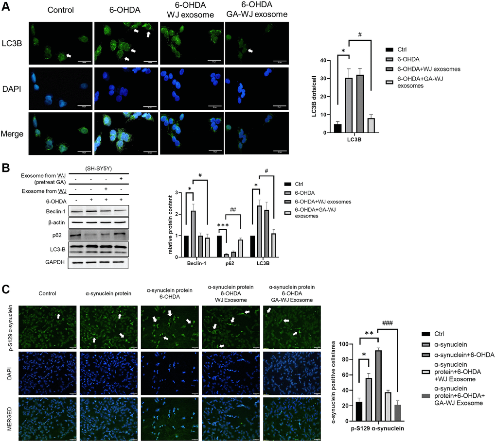 GA pre-treated WJMSCs exosomes repair excessive autophagy in 6-OHDA stimulated model. (A) The intensity and puncta of LC3-B were measured by immunofluorescence and DAPI staining. The white arrows indicate the dots showing increased puncta. (B) Immunoblot assays were performed to examine the Beclin-1, p62, and LC3-B proteins in the 6-OHDA damage model. (C) Immunofluorescence staining with alpha-synuclein p-129 anti-body after alpha-synuclein recombinant protein treatment in 6-OHDA damage model in SH-SY5Y cells. The white arrows indicate the expression of alpha-synuclein p-129. *P  0.05, **P ***P #P  0.05, ##P ###P 