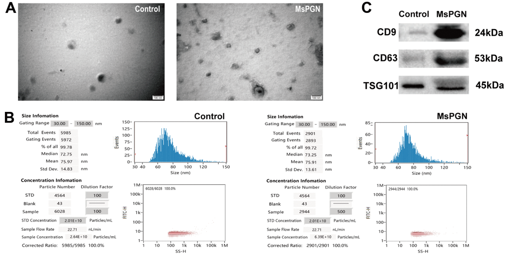 (A) Electron microscopic images of extracted exosomes revealed cup-shaped structures with a diameter of about 30–160 nm. Scale bar: 100 nm. (B) Nanoparticle tracking analysis (NTA) revealed the diameter of isolated extracellular vesicles (EVs) is consistent with that of exosomes. (C) Western blotting revealed CD9, CD63 and TSG101 proteins in exosome samples.