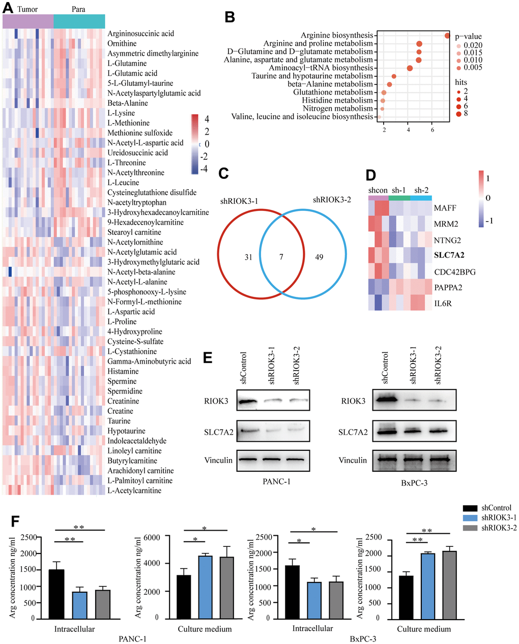 Metabolomic and transcriptional profiling reveals RIOK3 promotes arginine uptake in PDAC cells by upregulating SLC7A2 expression. (A) Heatmap of the differential metabolites of high-RIOK3 expression PDAC tissues compared with the paired adjacent normal tissues based on nontargeted metabolomic analysis (| Log2FC |>1, pB) KEGG pathway enrichment analysis of the 47 differential metabolites. (https://www.metaboanalyst.ca/). (C) Venn diagram summarizing that 7 mRNAs were detected in the two independent RIOK3-knockdown cells (| Log2FC |>1, pD) Heatmap of 7 mRNAs that were detected in the two independent RIOK3-knockdown cells (| Log2FC |>1, pE) Western blot analysis of RIOK3 and SLC7A2 in shRIOK3-1/2 cells (PANC-1 and BxPC-3 cells, respectively). One-way ANOVA test. (F) The content of Arg was analyzed in the intracellular and culture medium of shRIOK3-1/2 cells (PANC-1 and BxPC-3 cells, respectively). One-way ANOVA test. All experiments were performed independently at least three times. The star (*) symbol denotes the level of statistical significance: * p 
