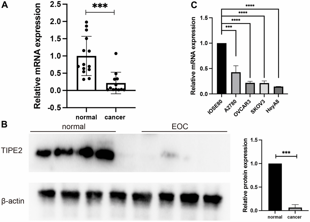 TIPE2 expression was decreased in human EOC. (A) qRT-PCR was used to measure TIPE2 mRNA expression in clinical samples from EOC (n=12) and non-cancer individuals (n=14). TIPE2 mRNA was shown to be considerably lower in EOC patients than in normal ovarian tissues. (B) Western blot examination of the relative expression of TIPE2 in EOC (n=4) and normal control samples (n=4). TIPE2 expression was normalized to β-actin. (C) qRT-PCR was conducted to assess TIPE2 RNA levels in IOSE80, a non-tumorigenic human-derived ovarian cell line, and 4 EOC cell lines, A2780, OVCAR3, SKOV3, HeyA8 (n=3). β-actin was used as an internal control. Data are presented as mean± SD. Statistical significance is denoted by the following symbols: ***p p 