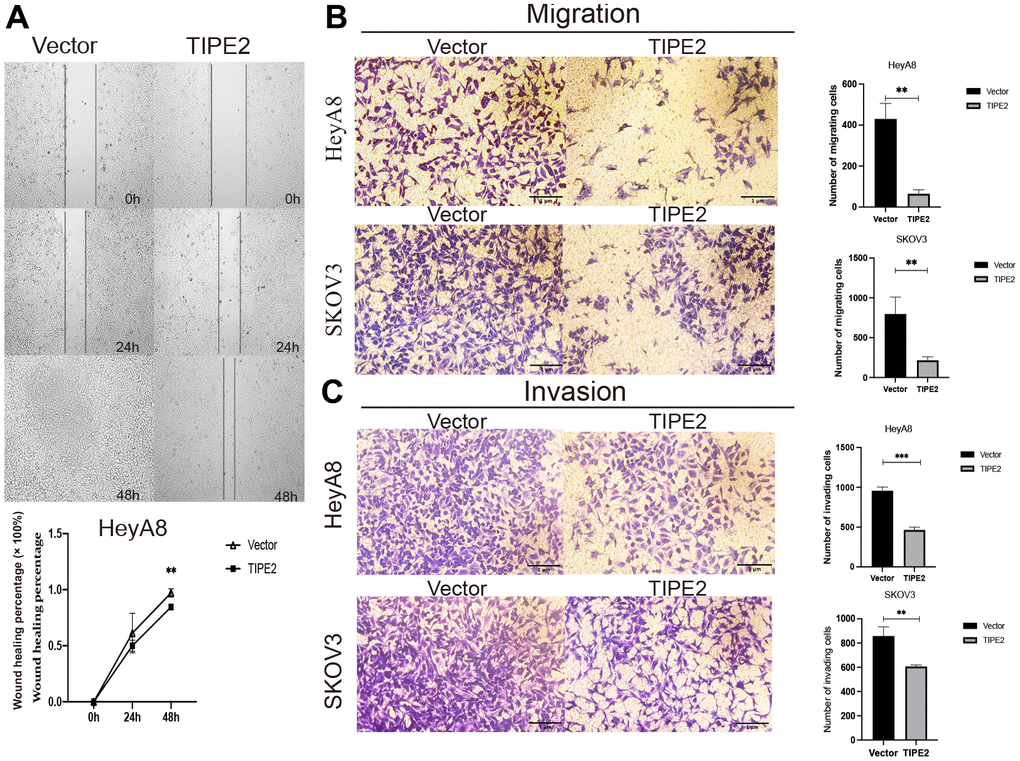 Overexpression of TIPE2 suppresses the migration and invasion of EOC cells. (A) HeyA8 cell migration was evaluated by the wound-healing assay using Culture-Inserts for Live Cell Analysis. Cells were seeded in culture inserts with a concentration of 3×105/ml. After cells had grown to a dense cell layer overnight, inserts were carefully peeled off, resulting in a gap of 500 μm between the cell population. The wounded cell layer was photographed at times 0, 24, and 48h under the microscope. The invasive capability was determined by measuring the reduction in wound area between 0, 24, and 48h in HeyA8 cells (n=3). (B) Inhibition of cell migration in transwell assay. HeyA8 and SKOV3 cells transfected with TIPE2, and its control group was added to the upper chamber of a 24-well transwell. After incubation for 24 hours, the tumor cells on the bottom side of the chamber were fixed and stained with crystal violet (n=3). (C) Inhibition of cell invasion in a transwell assay. HeyA8 and SKOV3 cells transfected with TIPE2, and its control group were incubated for 48 hours in the upper chamber with Matrigel transwell filters from which cancer cells can invade into the lower chamber. Cells on the surface of the lower chamber were fixed and stained with crystal violet (n=3). Data are presented as mean ± SD. Statistical significance is indicated as: **p p 