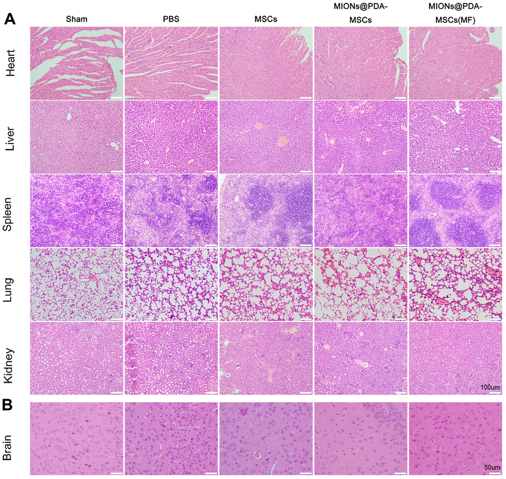 Histopathological changes observed in different organs of mice in each group. (A) The organs of each group were stained with hematoxylin and eosin. scale bars = 100 μm. (B) Pathological changes in cortical tissue. scale bars = 50 μm.