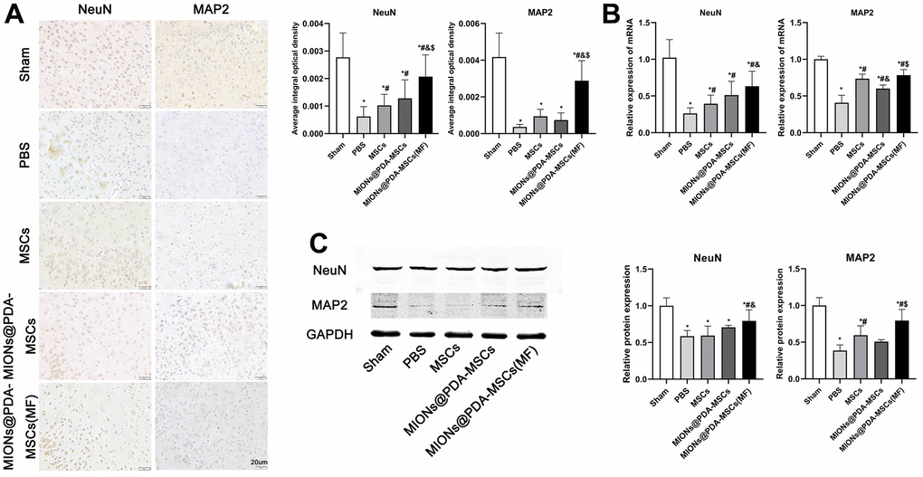 HUMSCs exert neuroprotective effects in vivo. (A) Immunofluorescence analysis, (B) relative mRNA expression, and (C) western blot analysis of neuronal markers (MAP2 and NeuN) in the cortex tissues of mice. *p #p &p $p 