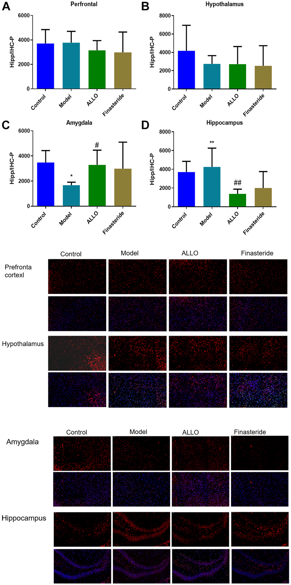 Expression of GABAA-Rα4 in brain regions of rats in each group. Red labeled GABAA-Rα4, nuclei were labeled with DAPI (blue). (A) α4 subunit expressions in the prefrontal cortex of rats. (B) α4 subunit expression in the hypothalamus of rats. (C) α4 subunit expression in the amygdala of rats. (D) α4 subunit expressions in the hippocampus of rats. Compared with normal group: *p **p #p ##p 