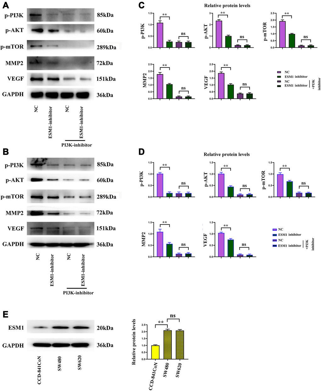 ESM1 shows an elevated expression in CRC cells and promotes the proliferation of CRC cells. (A, B) Relative protein expressions of p-PI3K, p-Akt, p-mTOR, MMP-2 and VEGF in ESM1-NC group, ESM1-mimic group, ESM1-NC + PI3K inhibitor group and ESM1-mimic + PI3K inhibitor group. (C, D) Expression of ESM1 in SW480 and SW620 cells. (E) Relative protein expression of ESM1 in CCD-841CoN, SW480 and SW620 cells. **p p > 0.05.