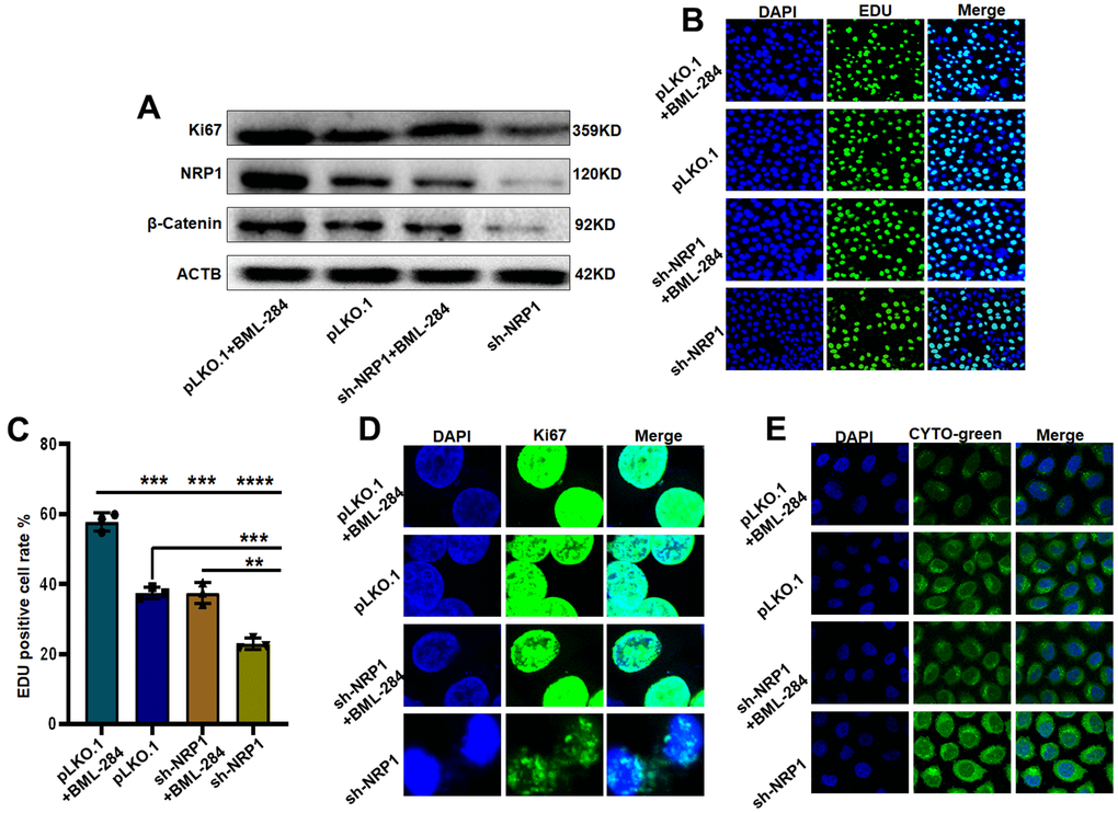 NRP1 regulates tumour autophagy and proliferation through the Wnt/β-catenin pathway. (A) Western blot detection of relevant signaling pathways. (B, C) EdU was used to detect changes in cell proliferation ability under different treatments. (D) cellular immunofluorescence were used to detect changes in cell proliferation ability under different treatments. (E) Detection of autophagy under different group treatments. (*PPPP