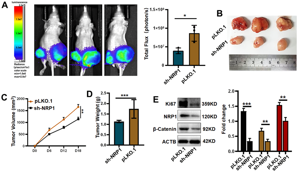 Verifying the ability of NRP1 to regulate tumors in vivo. (A) Detection of xenografts by animal imaging. (B) Image of xenograft tumor. (C) Tumor volume growth curve. (D) Tumor weight. (E) Western blot protein detection and quantitative analysis. (*PPPP