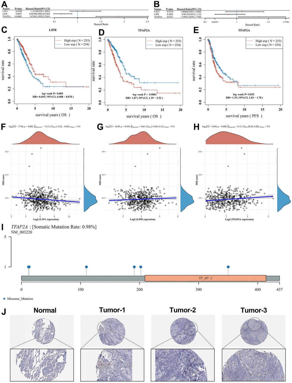 Survival analysis of potential prognostic biomarkers and identification of the core genes. Results of (A) OS and (B) PFS survival analysis for the potential prognostic biomarkers. (C) Relationship between LIFR expression and OS. (D) Relationship between TFAP2A expression and OS. (E) Relationship between TFAP2A expression and PFS. Correlation studies of potential prognostic genes with MSI, in which (F) CAV1 was significantly associated with MSI, while (G) LIFR was non-significantly associated with MSI as well as (H) TFAP2A was significantly associated with MSI. (I) Lollipop charts of the mutation landscape of TFAP2A, showing a somatic mutation rate is 0.98%. (J) Protein expression of TFAP2A in normal and LUAD tissues in pathological sections, indicating that TFAP2A was highly expressed in LUAD samples.