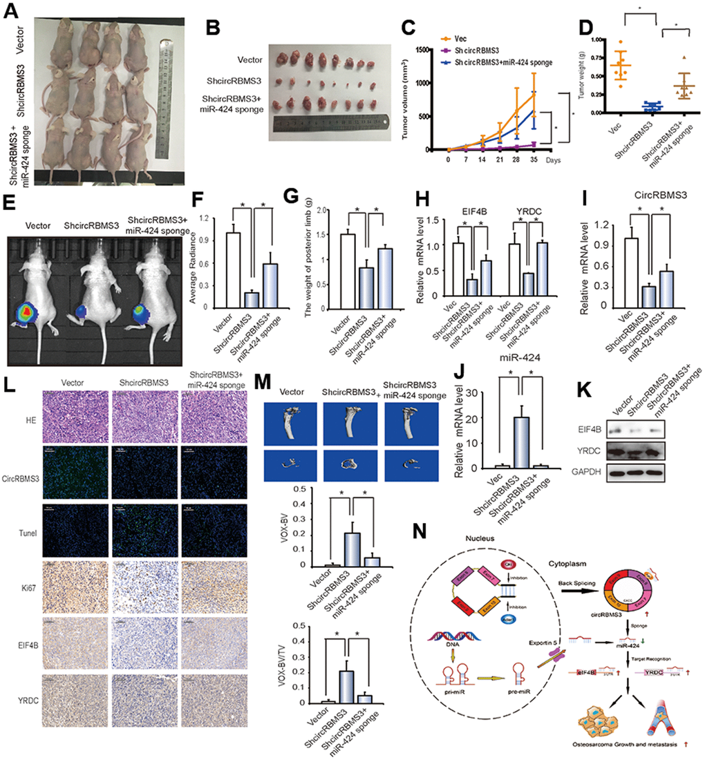 circRBMS3 functions as a miR-424 sponge to promote tumorigenesis in vivo. (A, B) Nude mice were injected with 5 × 106 143B stable cells. Four weeks later, tumors were dissected and photographed. (C) The graph represents tumor volumes (v = ab2/2) at injection with control cells or cells transfected with circRBMS3 short hairpin (sh)-RNA or co-transfected with circRBMS3 shRNA and miR-424 sponge (n = 6 per group). Data represent the mean ± SD (n = 8). (D) Average tumor weight in each group at the end of the experiment. Data represent the mean ± SD (n = 8). * P E) In vivo imaging of tibia tumor. (F) Average radiance of orthotopic xenograft nude mice. (G) The limb weight of orthotopic xenograft nude mice. (H) RT-qPCR analysis of EIF4B and YRDC expression in tumors from xenograft mice. (I, J) Knockdown efficiency of circRBMS3 and miR-424 in tumors from orthotopic xenograft nude mice. (K) Western blot analysis of EIF4B and YRDC in tumors from xenograft mice. (L) Histological analysis of tumor tissues by hematoxylin and eosin staining. EIF4B and YRDC expression was examined by immunohistochemistry. Representative images are shown. (M) MicroCT quantification of the specific trabecular bone volume [BV/TV (%)] and the cortical BV (mm3)] were calculated for the tibia of tumor-bearing mice in the different groups. (N) Schematic illustration of the circRBMS3/miR-424 axis.