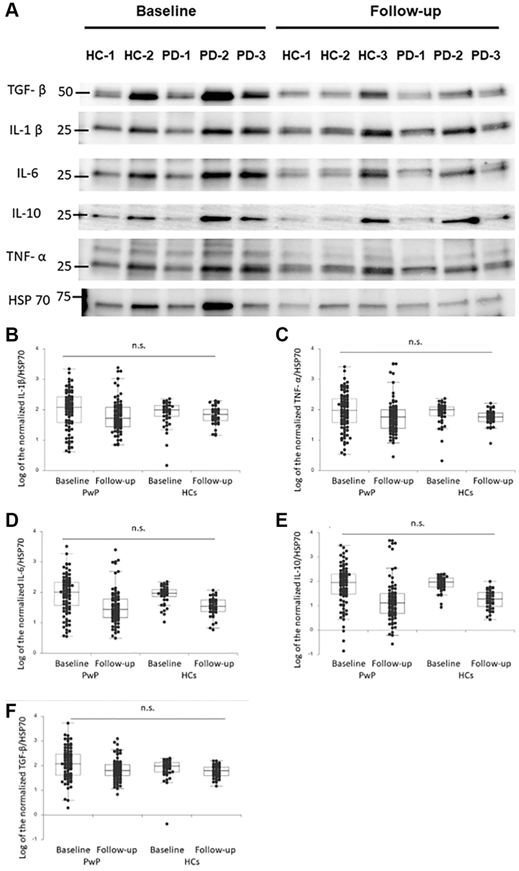 (A) Baseline and follow-up plasma extracellular vesicle (EV)-derived cytokine profiles of people with Parkinson’s disease (PwP) and healthy controls (HCs). Representative protein blot images of cytokines: interleukin (IL)-1β, IL-6, IL-10, tumor necrosis factor (TNF)-α, and transforming growth factor (TGF)-β. Heat-shock protein 70 was the protein loading control. (B–F) Comparison of plasma EV-derived IL-1β (B), TNF-α (C), IL-6 (D), IL-10 (E), and TGF-β (F) levels of PwP and HCs at baseline and follow-up. Data are presented as a dot plot with median values and first and third quartiles. Abbreviation: n.s.: nonsignificant.