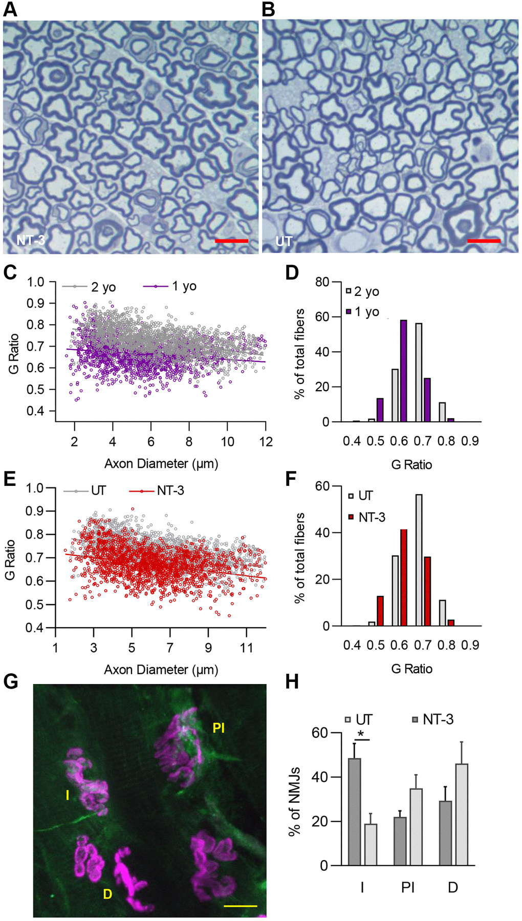 NT-3 gene transfer improves myelin thickness of peripheral nerves and neuromuscular junction assembly in C57BL/6 mice. Representative semithin, toluidine blue–stained cross-sections of tibial nerves from (A) treated and (B) untreated C57BL/6 mice. Scale bar = 10 μm. (C) Myelin thickness significantly decreased with age in 2-year-old mice compared to 1-year-old counterparts (1 yo, r2 = 0.0363; 2 yo, r2 = 0.2245; Linear regression, slopes are significantly different, p D) The shift toward thinner myelin can also be observed in percent distribution graph with aging. (E) A notable increase of myelin thickness was observed with treatment compared to samples from untreated (NT-3, r2 = 0.0989; UT, r2 = 0.2245; Linear regression, slopes are significantly different, p = 0.0037) and (F) percent analysis of g ratio of treated cohort displayed a distribution that peaks at 0.6 (n = 6 for both treated and untreated 2-year-old mice, n = 4 for 1-year-old control mice, with even sex distribution). (G) Representative image showing innervated (I), partially innervated (PI) and denervated (D) NMJs from the lumbrical muscles of the aged C57BL/6 mice. Scale bar = 10 μm. (H) Percent of the innervated NMJs in the treated mice was significantly higher than the untreated mice (*p = 0.0123). We evaluated an average of 41.2 NMJs per mouse (n = 4 mice for each cohort with equal sex distribution). Data is represented as mean ± SEM; Two-way ANOVA, Sidak’s multiple comparisons test; *p 