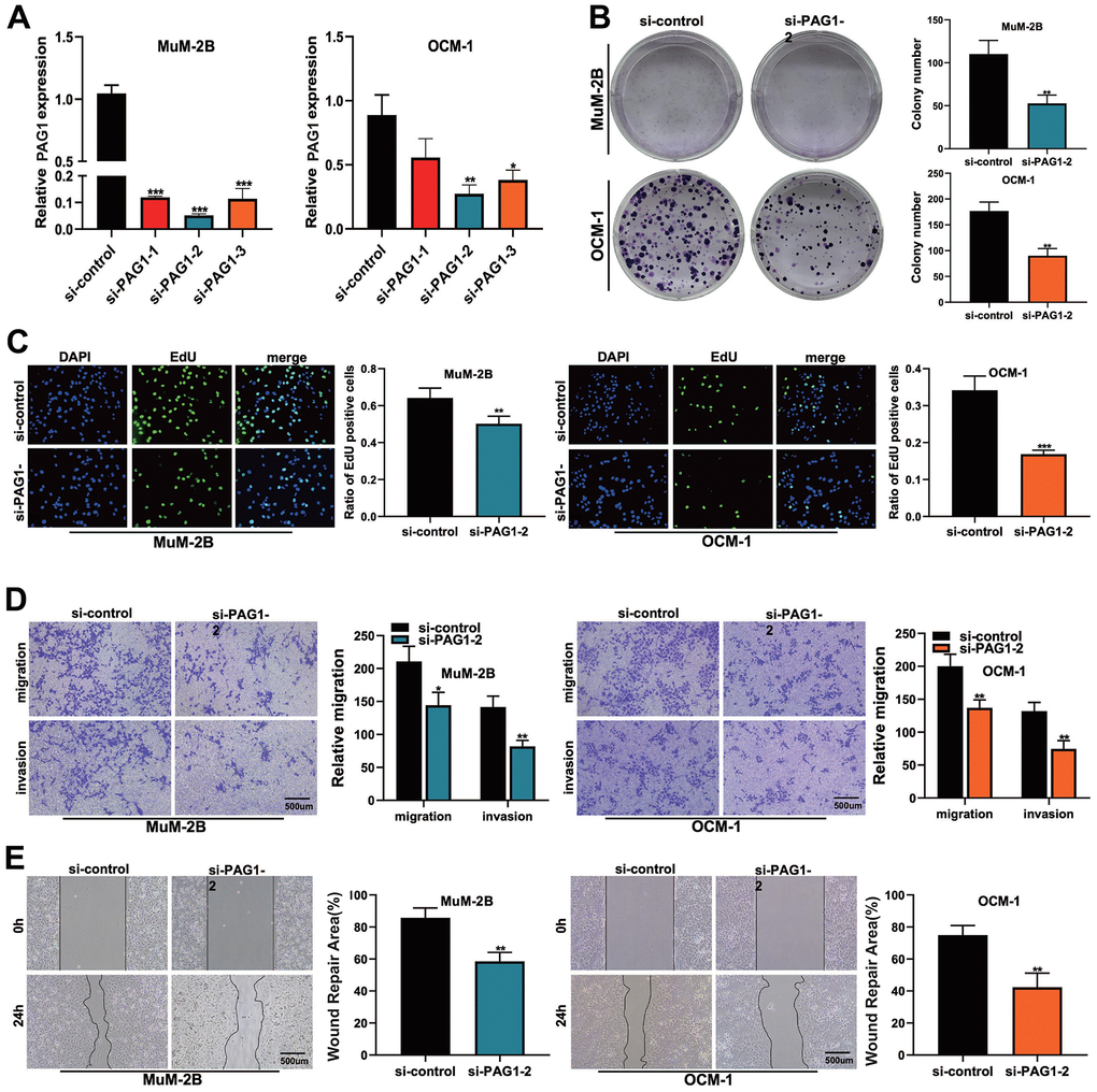 The function of PAG1 in UVM cell line was verified by cell assay. (A) Knockdown efficiency of PAG1 gene. The knockdown efficiency of si-PAG1-2 group was the highest. (B) Clone formation experiment. The proliferation ability of MUM-2B and OCM-1 cell lines decreased significantly after PAG-1 knockdown. (C) EdU assay. (D) Transwell experiment. The migration and invasion ability of MuM-2B cell lines and OCM-1 cell lines were significantly reduced after PAG-1 knockdown. (E) Wound healing experiment.