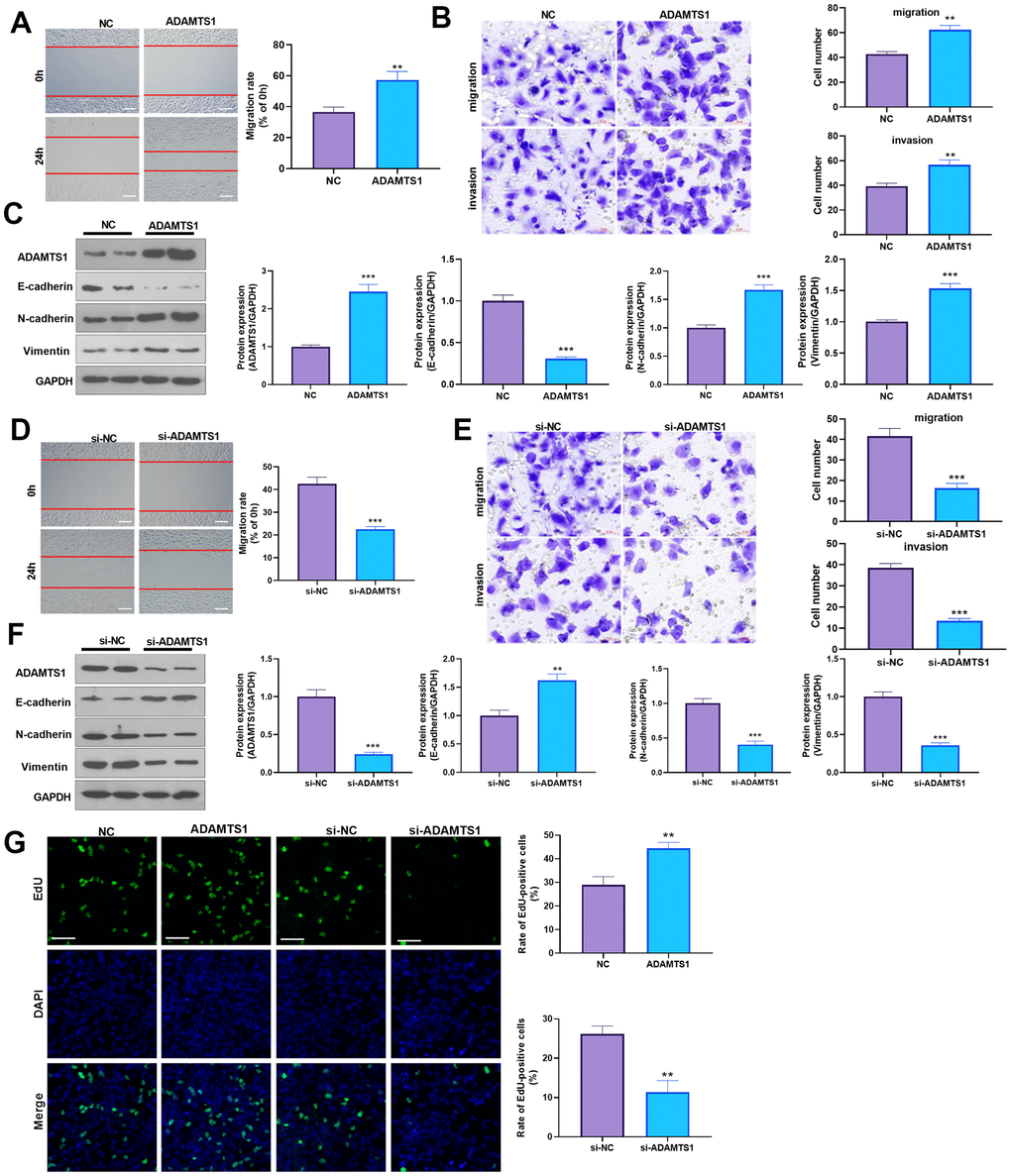 ADAMTS1 promotes migration, invasion, and EMT of A549 cells. ADAMTS1 overexpression plasmids or si-ADAMTS1 were transfected into A549 cells. (A) Wound-healing assay was used for detecting the migration of A549 cells transfected with ADAMTS1 overexpression plasmids. (B) Transwell examined the migration and invasion of A549 cells (scale bar=50 μm). (C) Protein expressions of E-cadherin, N-cadherin, and Vimentin in A549 cells were detected using Western blot. NC=negative control. (D) The wound-healing assay showed the migration of A549 cells after the knockdown of ADATMS1. (E) Transwell assays showed the migration and invasion of A549 cells after the knockdown of ADATMS1 (scale bar=50 μm). (F) Protein expressions of E-cadherin, N-cadherin, and Vimentin in A549 cells were detected using Western blot. (G) EdU staining was used for detecting cell proliferation. Scale bar=100 μm. **PP