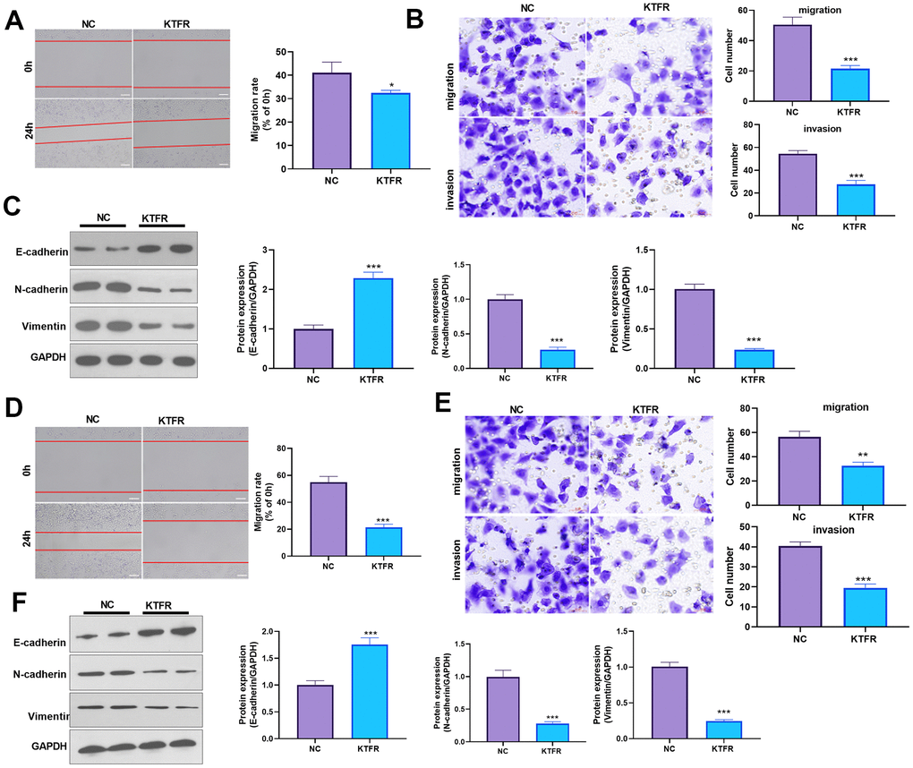 Effects of KTFP on migration, invasion, and EMT of the NSCLC A549 and H226 cell line. (A) Wound-healing showed the migration of A549 cells after adding KTFR. (B) Transwell assays showed the migration and invasion of A549 cells decreased after adding KTFR (scale bar=50 μm). (C) Protein expressions of E-cadherin, N-cadherin, and Vimentin in A549 cells were detected using Western blot analysis. (D) Wound-healing showed the migration of H226 cells was decreased after adding KTFR. (E) Transwell assays showed the migration and invasion of H226 cells were decreased after adding KTFR (scale bar=50 μm). (F) Protein expressions of E-cadherin, N-cadherin, and Vimentin in H226 cells were detected using Western blot. *PPP