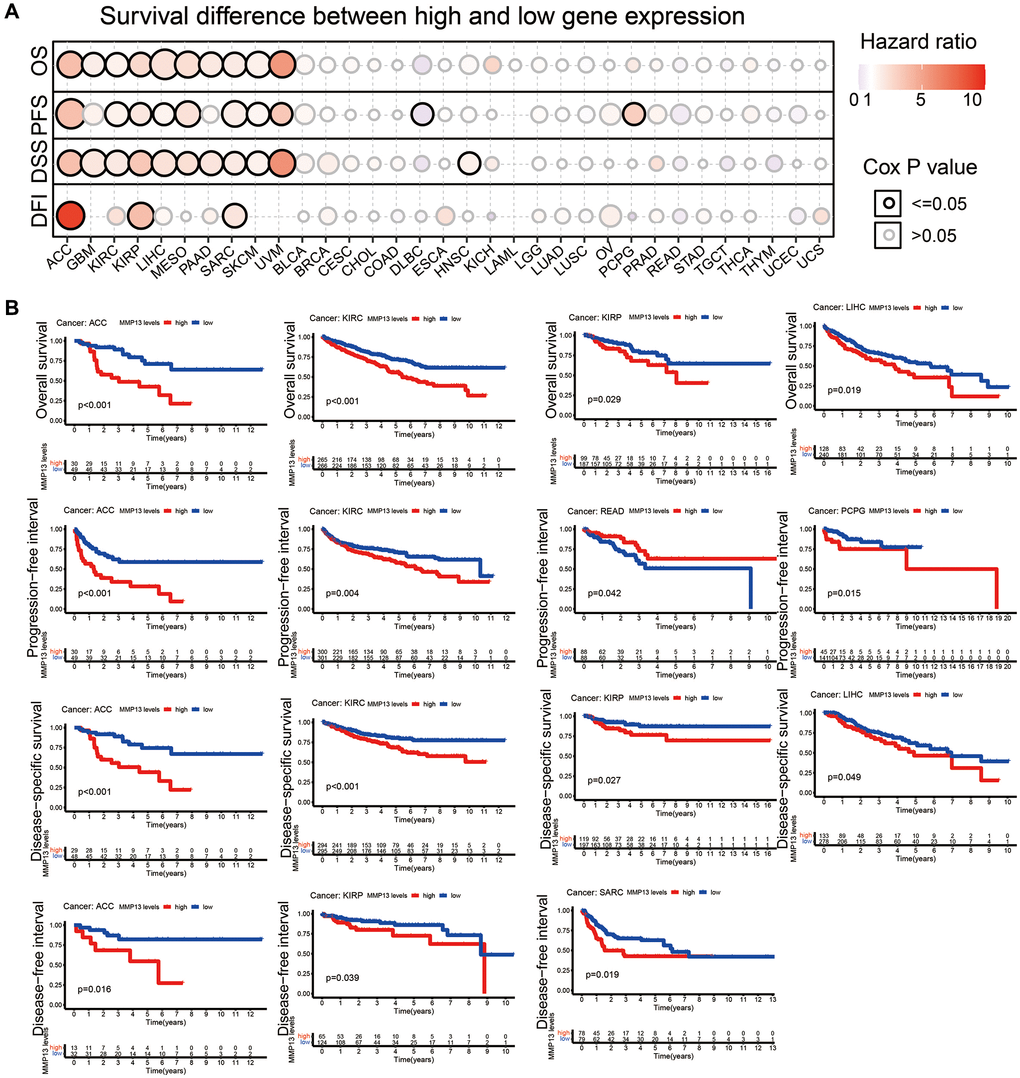 Correlation between MMP13 expression and prognosis. (A) Analysis of the relationship between MMP13 mRNA expression and patient survival in various cancers, including OS, PFS, DSS, and DFI. (B) Kaplan-Meier survival curve showed that MMP13 gene expression was significantly associated with survival in patients with certain types of cancer, including ACC, KIRC, KIRP, and LIHC. Abbreviations: OS: overall survival; PFS: progression-free survival; DSS: disease-specific survival; DFI: disease-free interval.