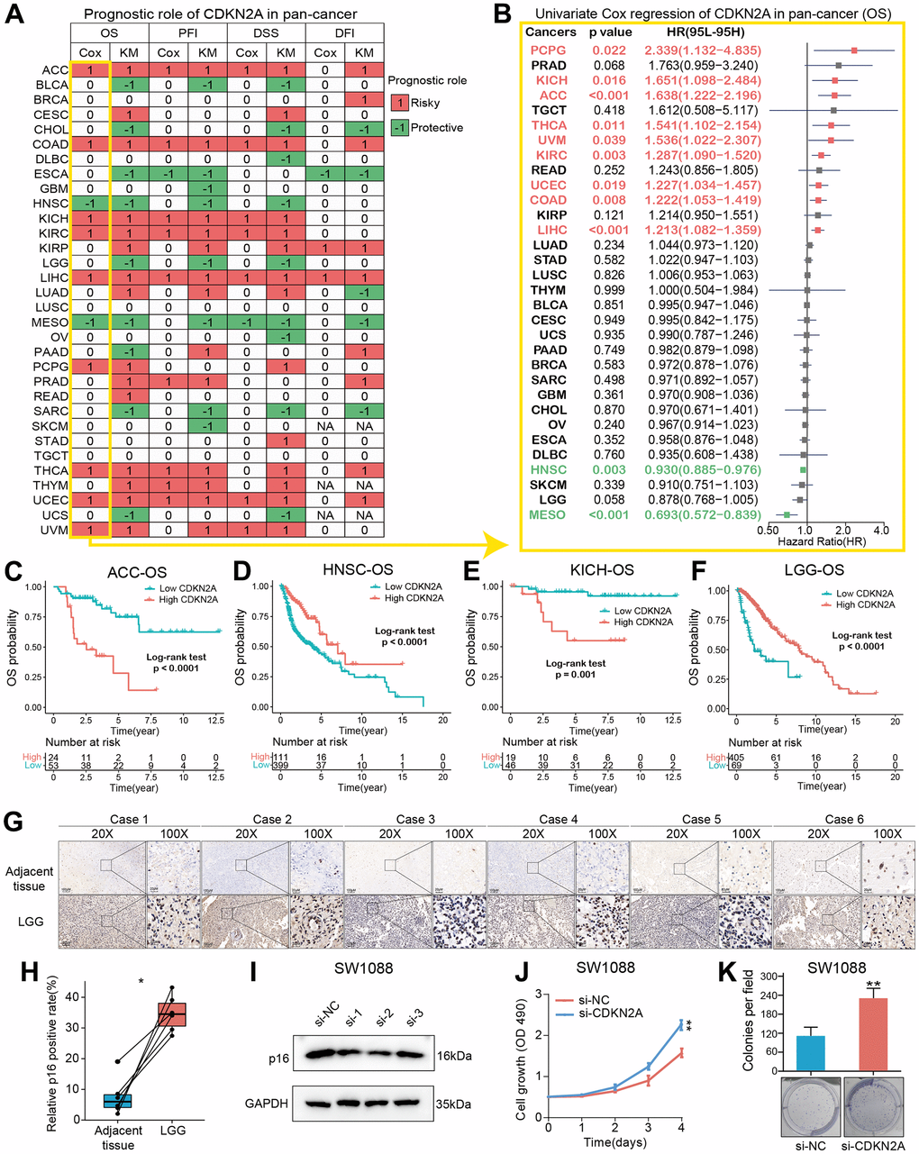 Prognostic roles of CDKN2A in pan-cancer. (A) Summary of the correlations between CDKN2A expression and overall survival (OS), disease-free interval (DFI), disease-specific survival (DSS) and progression-free interval (PFI) of cancer patients according to univariate Cox regression and Kaplan-Meier model. Red indicates that CDKN2A is the risk factor affecting prognosis of cancer, and green indicates a protective factor. Only p value B) Through univariate Cox regression method, forest map shows the prognostic role of CDKN2A in cancer. The red cancer type indicates that CDKN2A is a statistically significant risk factor. (C–F) Kaplan-Meier total survival curve of CDKN2A in ACC-OS (C), HNSC-OS (D), KICH-OS (E) and LGG-OS (F). (G) Immunohistochemical images showed the expression and location of p16 protein in six pairs of LGG and adjacent tissues. (H) Paired-t test showed the statistical significance of p16 positive rate of the IHC results. (I) Western blot validated the knock-down effects of the siRNAs in SW1088 cells. (J, K) CCK8 cell proliferation analysis (J) and cell colony formation assay (K) showed the discrepancy of cell proliferation abilities between SW1088 cells with or without CDKN2A knock-down.