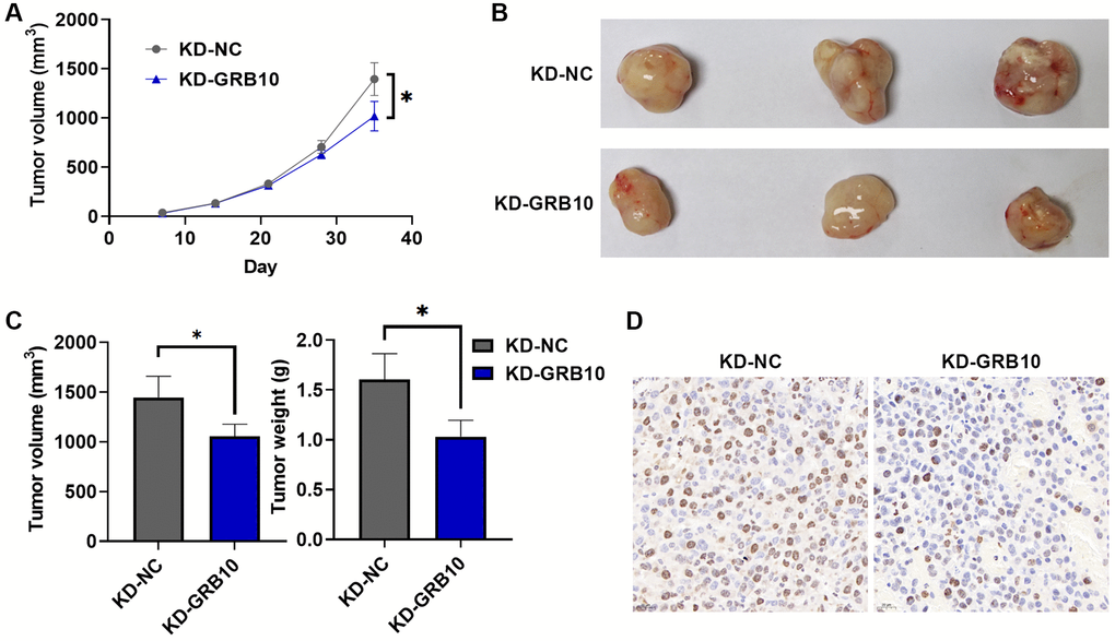 GRB10 knockdown inhibited tumor growth in vivo. (A) Tumor growth curve. Abbreviation: KD: knockdown group. (B) Representative pictures of subcutaneous tumors in each group. (C) Tumor volume and weight in a subcutaneous tumor model. (D) Ki67 immunohistochemical staining. *p **p ***p 