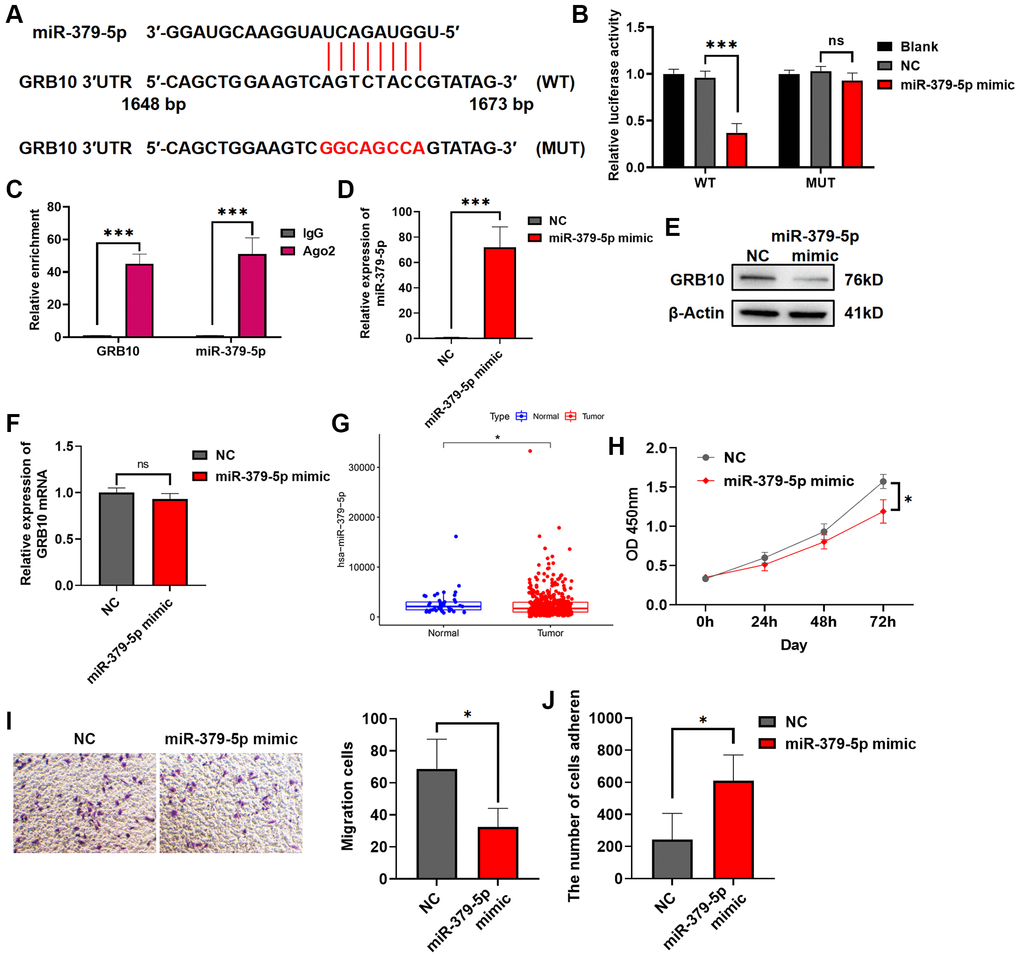 miR-379-5p reduces the proliferation and migration ability of gastric cancer by targeting GRB10. (A) Diagram of the GRB10 mRNA and miR-379-5p binding site. Abbreviation: KD: knockdown group. (B) The relative luciferase activity was measured with a dual-luciferase reporter assay. (C) RIP assay was conducted using an antibody against Ago2. (D) The relative expression of miR-379-5p was detected by qRT-PCR. (E) The expression of GRB10 was detected by Western Blot. (F) The relative expression of GRB10 mRNA was detected by qRT-PCR. (G) MiR-379-5p expression in the TCGA database. (H) Cell proliferation was determined by the CCK-8 assay. (D) Effects of miR-379-5p on cell adhesion ability. (I) Cell migratory ability detected by Transwell migration assay. (J) Effects of miR-379-5p on cell adhesion ability. *p **p ***p 