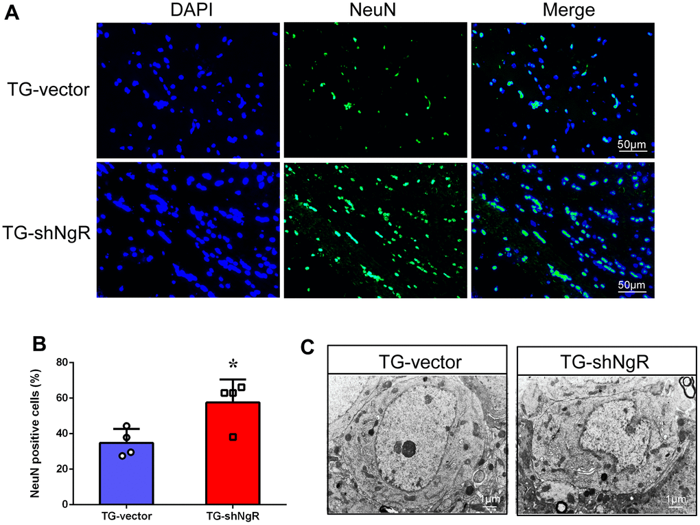 NgR reduction protects the neuronal morphology and number in APP/PS1 transgenic mice. (A) The coronal sections of the hippocampus were stained with an antibody against NeuN. (B) The numbers of the NeuN-positive cells in the hippocampus were quantified. (C) The neurons were observed under electron microscope. The images showed the hippocampal neurons in TG-vector mice and TG-shNgR mice, respectively. Data are presented as mean ± SEM. n = 3-4 male mice/group. The statistical analysis was performed by Student’s t test. *P 