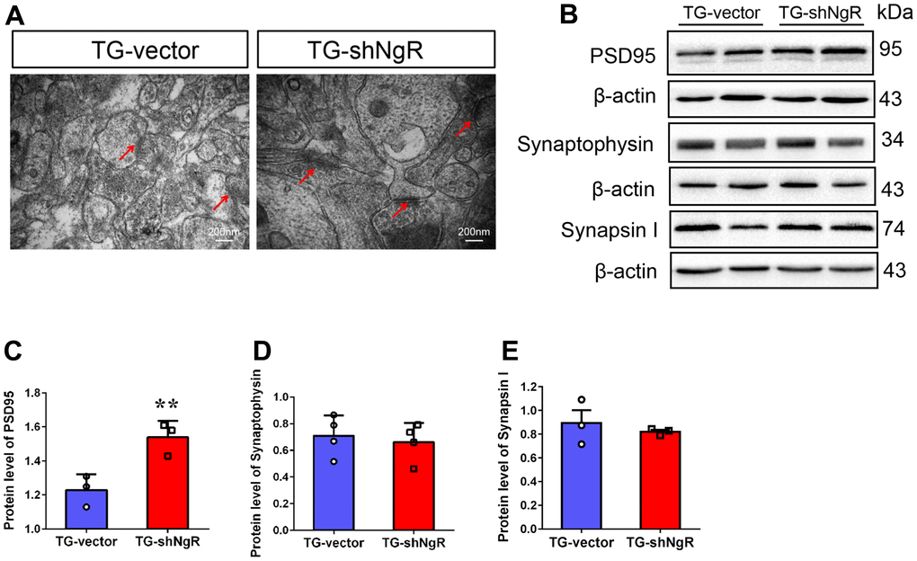 NgR decreased the postsynaptic density, but did not affect the presynaptic expression in the hippocampus of APP/PS1 transgenic mice. (A) The neuronal synapses were observed under electron microscope in hippocampus of TG-vector mice and TG-shNgR mice. The arrow points to postsynaptic dense bodies. (B–E) Representative micrographs of Western blot and densitometry analysis of PSD95, synaptophysin and synapsin I in the hippocampus. Data are presented as mean ± SEM. n = 3-5 male mice/group. The statistical analysis was performed by Student’s t test. *P P 