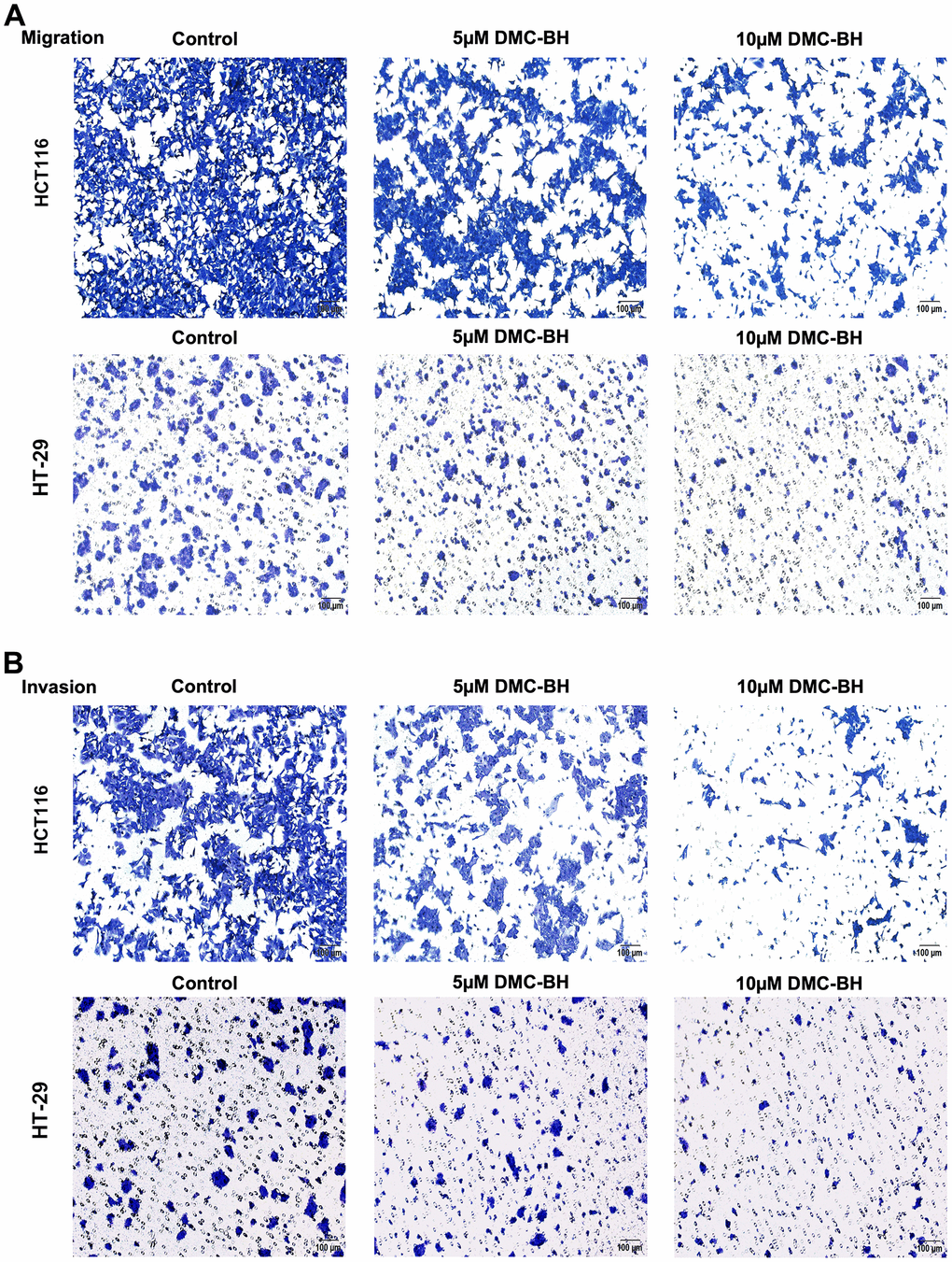 DMC-BH inhibits the migration and invasion of CRC cells in vitro. (A) Migration assay in HCT116 and HT-29 cells after DMC-BH treatment. (B) Invasion assay of HCT116 and HT-29 cells after DMC-BH treatment.