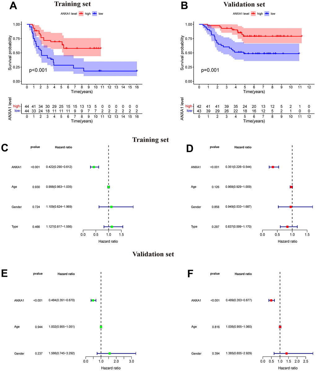 ANXA1-based survival curves, univariate and multivariate Cox regression analysis. (A) The results of Kaplan–Meier survival analysis based on the GSE17679 dataset suggested that patients in the ANXA1 low expression group had worse OS times than those in the low expression group (PB) The results of Kaplan–Meier survival analysis based on the GSE63157 dataset suggested that patients in the ANXA1 low expression group also had worse OS time, which was consistent with the training set (P=0.001). (C) Univariate Cox regression analysis for ANXA1 in the GSE17679 dataset (PD) Multivariate Cox regression analysis for ANXA1 in the GSE17679 dataset (PE) Univariate Cox regression analysis for ANXA1 in the GSE63157 dataset (PF) Multivariate Cox regression analysis for ANXA1 in the GSE63157 dataset (P