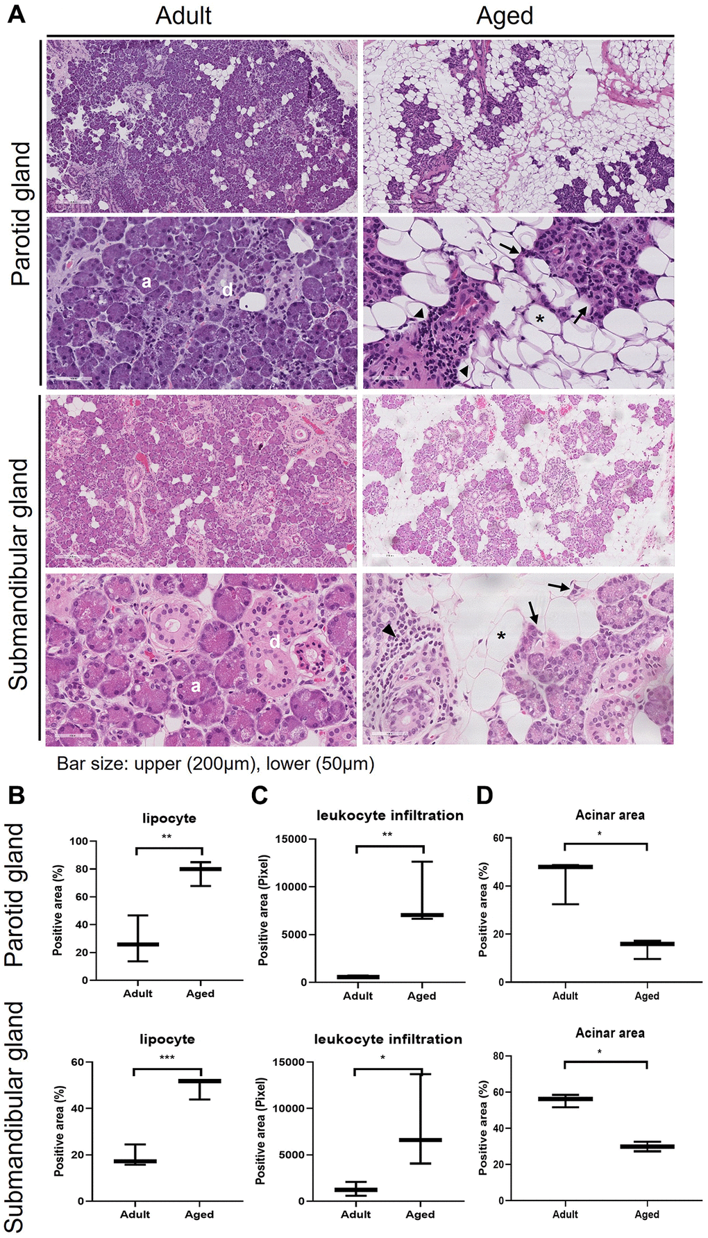 Hematoxylin and eosin (H&E) stained tissue sections showing age-related morphological changes in human parotid and submandibular glands. (A) The morphology of adult and aged salivary glands, bar size: upper (200 um), lower (50 um). (B–D) The quantifications of lipocyte, leukocyte infiltration and acinar area. Results are presented as the mean ± SD and T-test was performed for statistical analysis **p *p 