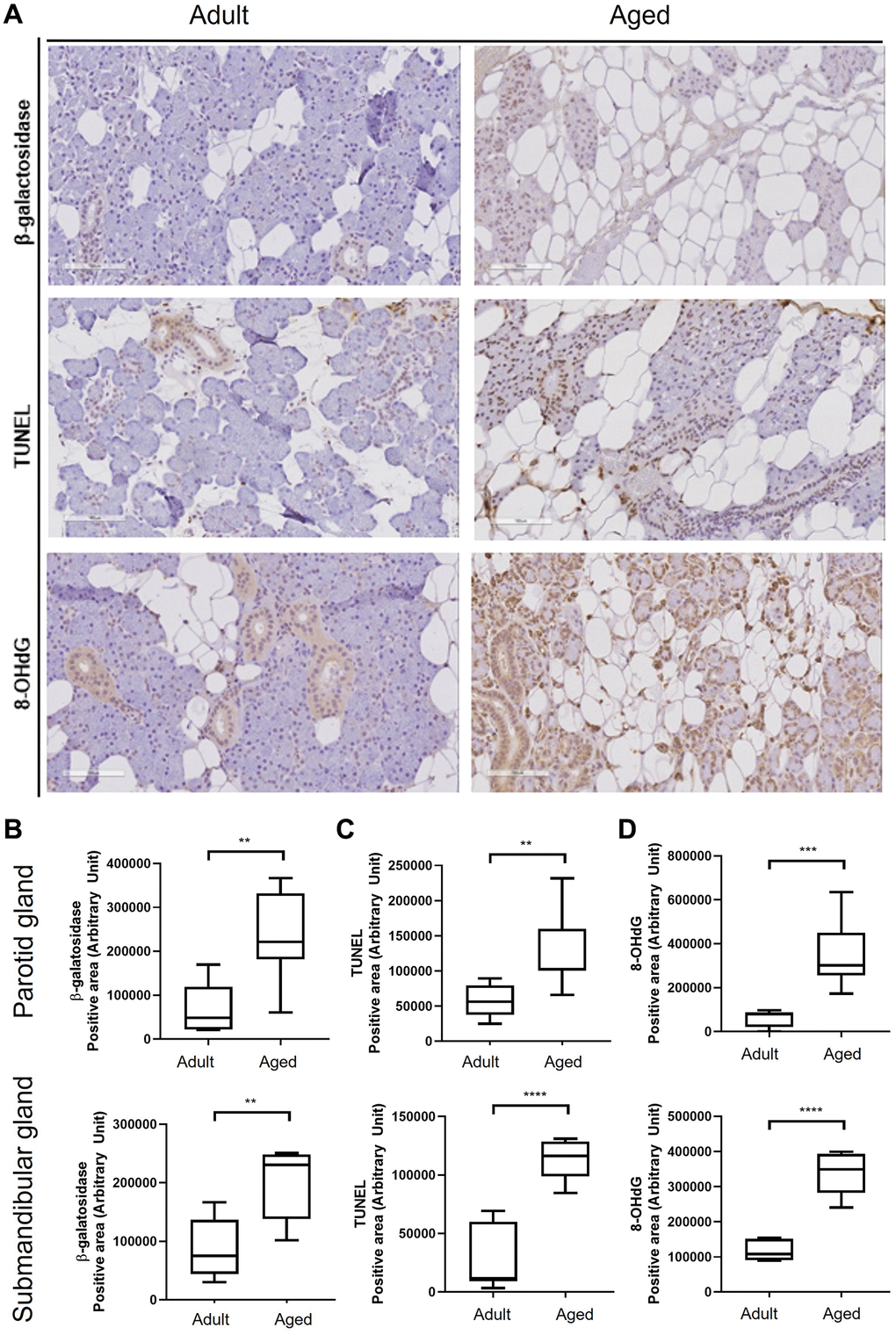 Cellular senescence in human salivary gland tissue. (A) β-Galactosidase assay, TUNEL assay, and the expression of 8-OHdG. (B) Quantitation of β-galactosidase positive areas. (C) Quantitative analysis of TUNEL (terminal deoxynucleotidyl transferase dUTP nick end labeling) positive areas. (D) Quantitative analysis of 8-OHdG (8-hydroxy-2' -deoxyguanosine) positive areas. Results are presented as the mean ± SD and T-test was performed for statistical analysis ****p ***p **p 