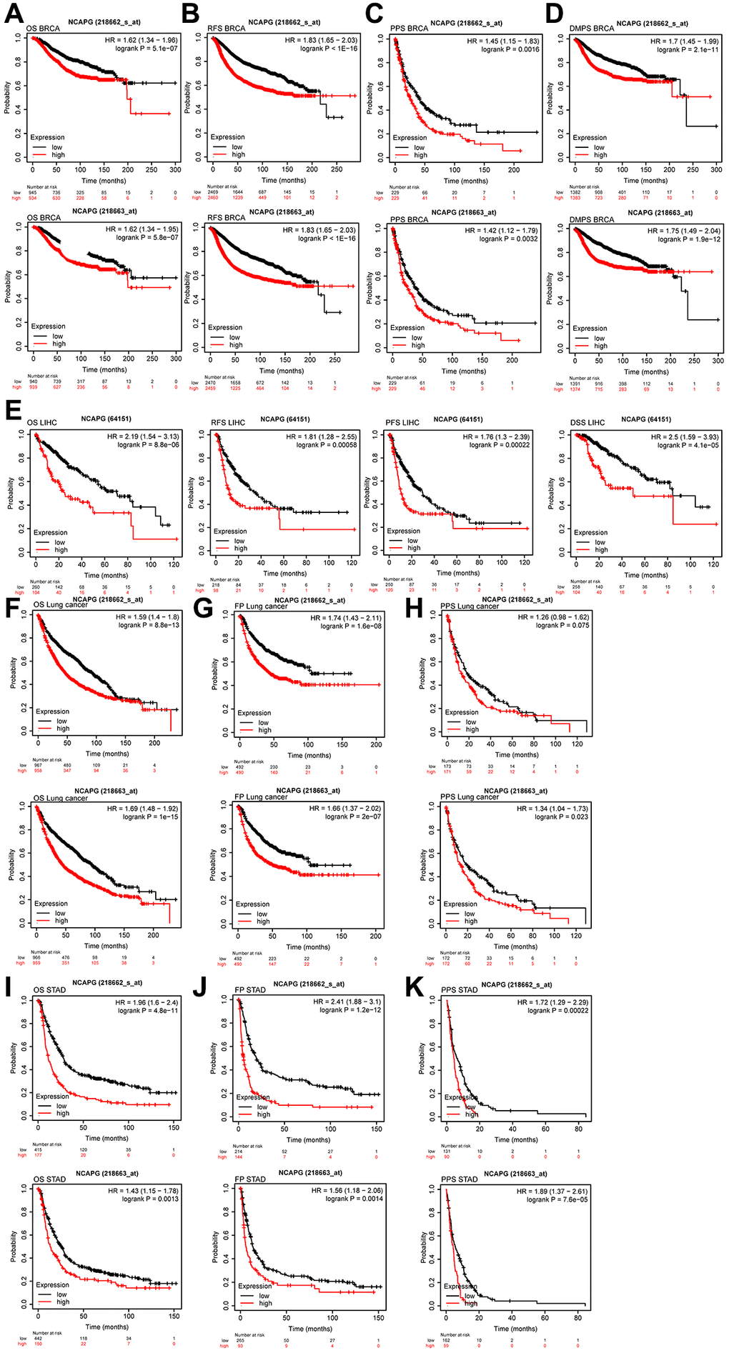 (A) OS of NCAPG (218663-s-at) in BRCA (n = 1879), OS of NCAPG (218663-at) in BRCA (n = 1879), (B) RFS of NCAPG (218663-s-at) in BRCA (n = 4929), RFS of NCAPG (218663-at) in BRCA (n = 4929), (C) PPS of NCAPG (218663-s-at) in BRCA (n = 458), PPS of NCAPG (218663-at) in BRCA (n = 458)(D) DMPS of NCAPG (218663-s-at) in BRCA (n = 2765), DMPS of NCAPG (218663-at) in BRCA (n = 2765), (E) OS (n = 364), PFS (n = 316), PFS (n = 370)and DSS (n = 362)of NCAPG in LIHC, (F) OS of NCAPG (218663-s-at) in lung cancer (n = 1925), OS of NCAPG (218663-at) in lung cancer (n = 1925), (G) FP of NCAPG (218663-s-at) in lung cancer (n = 982), FP of NCAPG (218663-at) in lung cancer (n = 982), (H) PPS of NCAPG (218663-s-at) in lung cancer (n = 344), PPS of NCAPG (218663-at) in lung cancer (n = 344), (I) OS of NCAPG (218663-s-at) in STAD (n = 592), OS of NCAPG (218663-at) in STAD (n = 592), (J) FP of NCAPG (218663-s-at) in STAD (n = 358), FP of NCAPG (218663-at) in STAD (n = 358), (K) PPS of NCAPG (218663-s-at) in STAD (n = 221), PPS of NCAPG (218663-at) in STAD (n = 221).