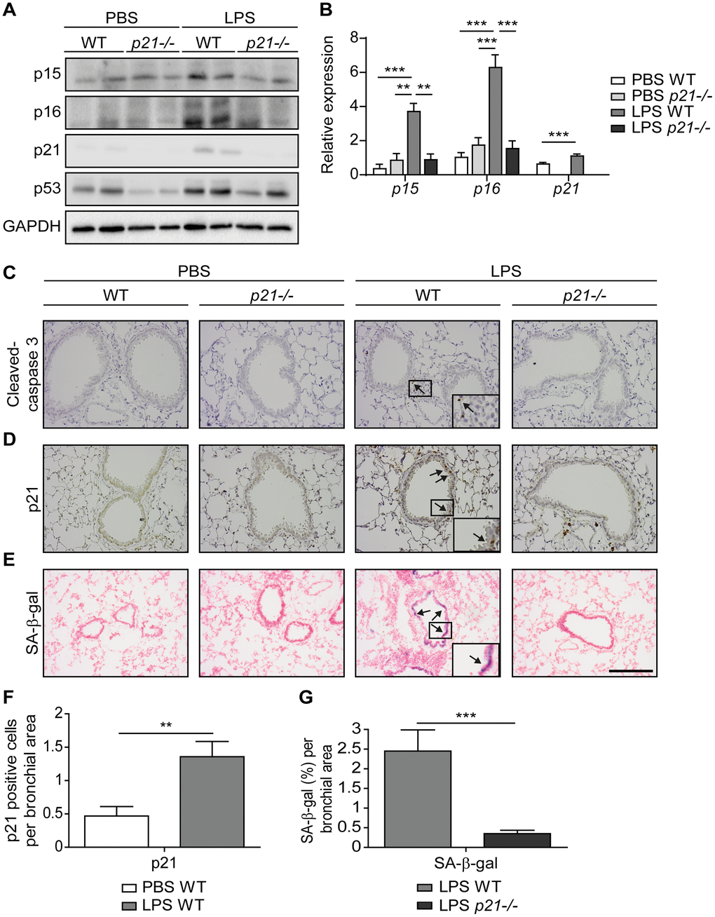 Accumulation of senescent cells is decreased in the lungs of p21-/- mice. WT and p21-/- mice were exposed to either PBS or aerosolized LPS (0.5 mg/ml), 3 times a week for 10 weeks. At 48 hours following the last LPS exposure, the lungs were harvested and frozen. Alternatively, lungs were harvested, fixed, and analyzed for markers of senescence. (A) Representative immunoblots for senescence-associated proteins p15, p16, p21 and p53 in the mice lungs. (B) mRNA expression levels of senescence markers p15, p16 and p21 in the mice lungs. (C, D) Immunohistochemistry (IHC) of lung sections for cleaved caspase 3, (C) and p21, (D). Scale bar represents 200μm. (E) SA-β-Gal staining of lung sections. Scale bar represents 200μm. (F) Quantification of the number of p21 positive cells per bronchial area, of the lung sections presented in (D). (G) Quantification of SA-β-gal (%) per bronchial area, of the lung sections presented in (E). Data information: Data were analyzed using one-way ANOVA, *PB), and by Student’s t-test, *pF, G). Data represent mean ±SEM (A, n=3; B, n=3-10; C–G, n=3-6 independent repeats).