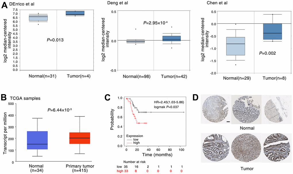 DDX5 expression is correlated with poor patient survival in gastric cancer. (A) The expression of DDX5 was analyzed in patients with gastric. DDX5 expression in gastric cancer samples and non-cancer controls; the publicly accessible gene expression data of DDX5 was obtained from Oncomine database. (B) DDX5 expression in gastric cancer samples and non-cancer controls; The publicly accessible gene expression data of DDX5 was obtained from The Cancer Genome Atlas (TCGA) database. (C) Kaplan-Meier overall survival curves according to DDX5 expression in patient cohorts in KM-plotter database. The percentage of survival patients in high DDX5 and low DDX5 groups at different time points are presented. (D) DDX5 expression in gastric cancer patient with or non-cancer controls was measured by immunohistochemical staining. The publicly accessible protein expression data of DDX5 was obtained from The Human Protein Atlas database. Data were analyzed with Student’s t-test, p values were shown. Scale bar 200μm.