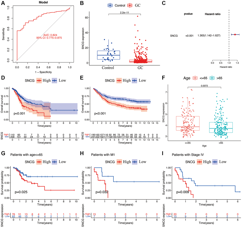 Functional analyses of SNCG. (A) ROC curves of SNCG. (B) Gene expression levels of SNCG in GC samples and normal control. (C) Univariate Cox regression of SNCG. Survival curve of SNCG in TCGA (D) and GSE84437 (E) cohorts. (F) Correlations between the expression of SNCG and age. The prognosis of SNCG under the stratifications of age {less than or equal to} 65 (G), M1 subtype (H), and AJCC stage IV (I).