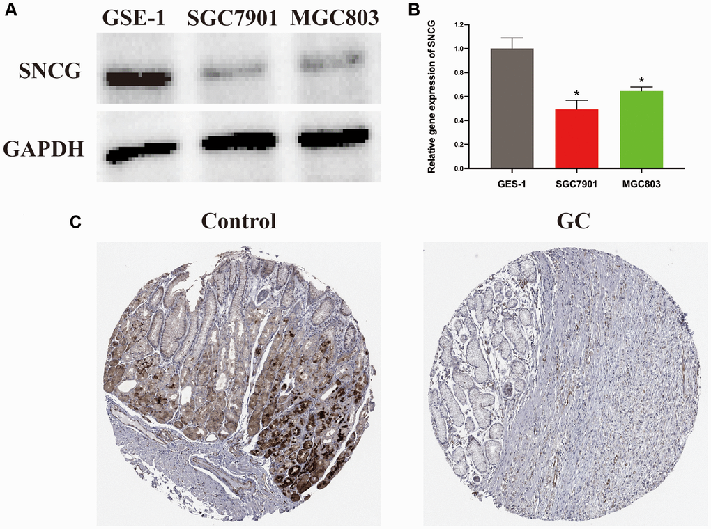 Expression level of SNCG in GC. (A) Western blot analysis of SNCG. (B) QRT-PCR analysis of SNCG. (C) Immunohistochemistry data of SNCG from HPA database.