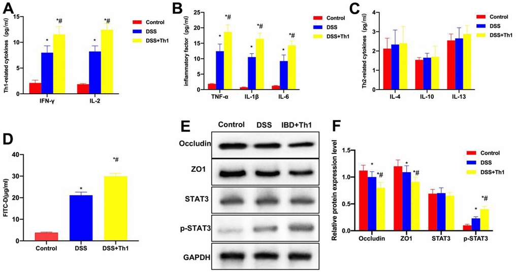 Th1 aggravated intestinal inflammation and reduced the TJ protein levels. (A) Th1 cell characteristic factors (n=10). The expression of IFN-γ and IL-2 in DSS significantly increased, while that in DSS+Th1 group further increased relative to DSS group, and the difference was significant compared with DSS group. *P#PB) Detection of inflammation cytokines (n=10). The levels of TNF-α, IL-6 and IL-1β in DSS group significantly increased, higher than those in Control group. The inflammatory factor levels in DSS+Th1 group further increased, and Th1 improved their tissue levels. *P#PC) Th2 cell characteristic factors (n=10). The levels of IL-4, IL-10 and IL-13 were not significantly different among Control, DSS and DSS+Th1 groups. (D) FITC-D (n=10). The FITC-D penetration rate in DSS group significantly increased, while that in DSS+Th1 group further increased relative to DSS group, and the mucosal permeability was apparently enhanced. *P#PE, F) Protein detection results (n=5). DSS induced the down-regulation of TJ proteins ZO1 and Occuldin, and their expression further decreased in DSS+Th1 group. At the same time, the STAT3 phosphorylation level increased. *P#P