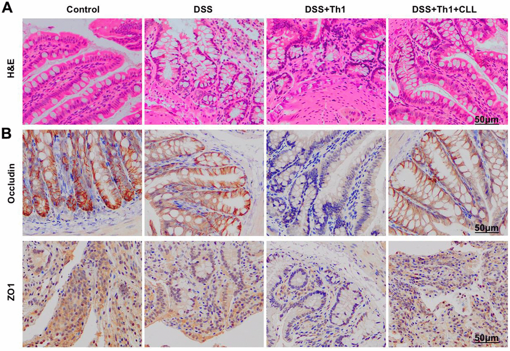 Changes of intestinal histopathology after the scavenging of mouse macrophages. (A) H&E (n=5). In DSS+Th1+CCL group, the tissue exhibited obvious inflammation and edema, which were markedly alleviated relative to DSS+Th1 group. (B) IHC (n=5). The levels of ZO1 and Occludin proteins in DSS+Th1+CCL group were markedly higher than those in DSS+Th1 group.