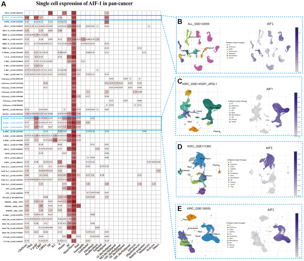 Single-cell expression of AIF-1 across cancers. (A) Summary of AIF-1 expression in various cell types in single-cell datasets. (B) Scatter plot showing the distributions of 7 different cell types in the GSE132509 ALL dataset. (C) Scatter plot showing the AIF-1 expression levels of cells in the GSE145281 KIRC dataset (D) Scatter plot showing the distributions of 12 different cell types in the GSE111360 KIRC dataset. (E) Scatter plot showing the distributions of 11 different cell types in the GSE139555 KIRC dataset.