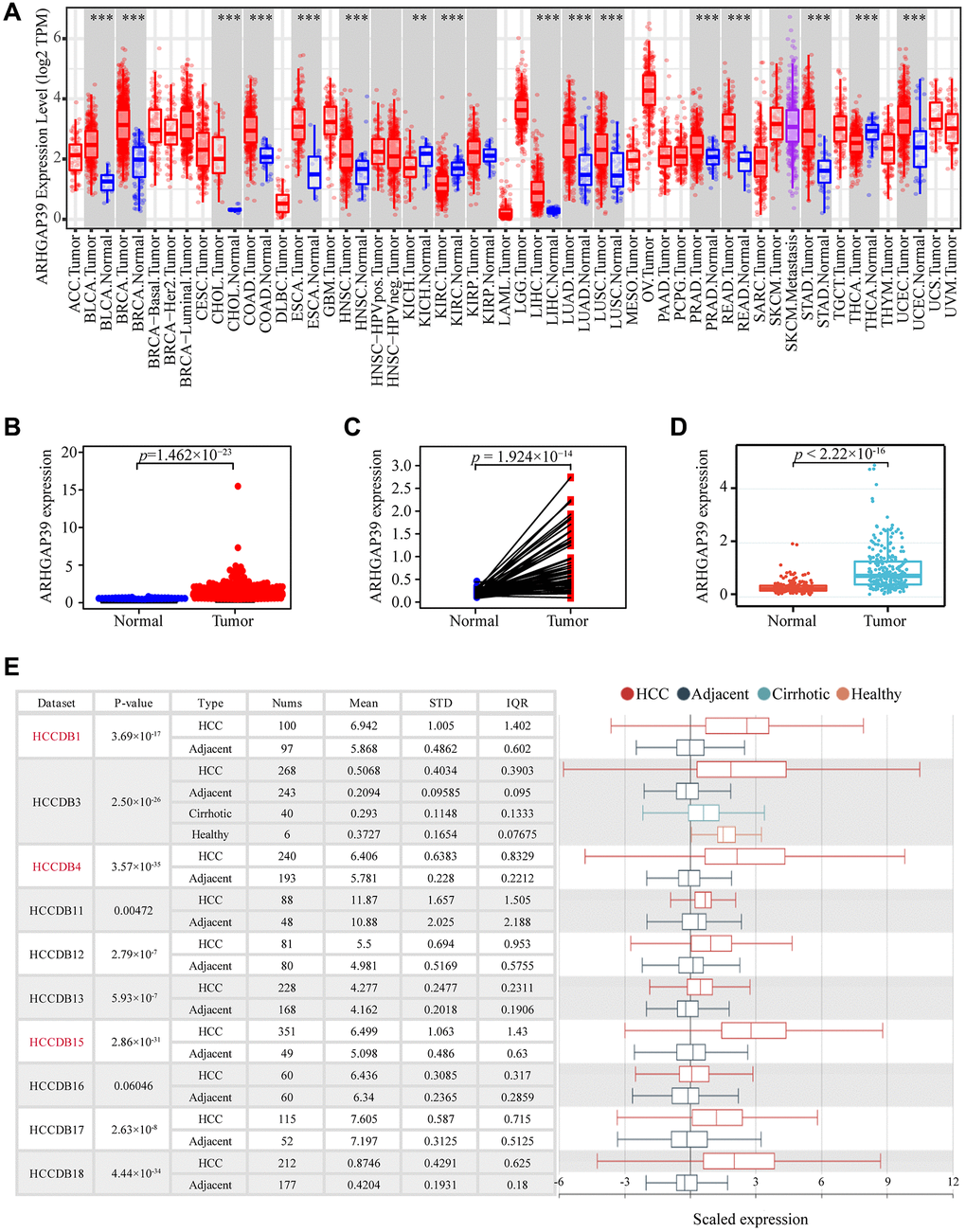 The expression of ARHGAP39 in HCC and other cancers. (A) Level of ARHGAP39 expression in a variety of cancer tissues (***p **p *p B) ARHGAP39 mRNA levels in tumor and normal tissues based on the TCGA database (p = 1.462e−23). (C) Paired differential expression map of ARHGAP39 between HCC tissues and normal tissues based on the TCGA database (p = 1.924e−14). (D) The mRNA expression level of ARHGAP39 in tumor and normal tissues in the ICGC (p E) HCCDB analysis of aberrant expression of ARHGAP39 in HCC patients.