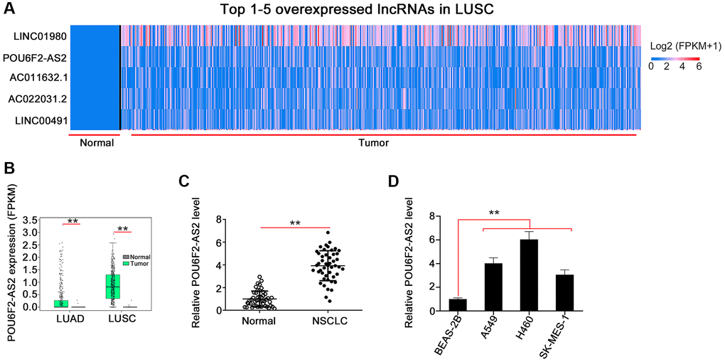 POU6F2-AS2 is overexpressed in NSCLC. (A) POU6F2-AS2 ranks the 2nd overexpressed lncRNA in LUSC. (B) POU6F2-AS2 level in LUAD and LUSC from TCGA database. **P C) POU6F2-AS2 level in NSCLC tissues compared with normal tissues from our own cohort. **P D) POU6F2-AS2 level in NSCLC cell lines. **P 